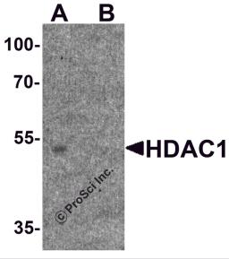 Western blot analysis of HDAC1 in human brain tissue lysate with HDAC1 antibody at 1&#956;g/ml in (A) the absence and (B) the presence of blocking peptide.