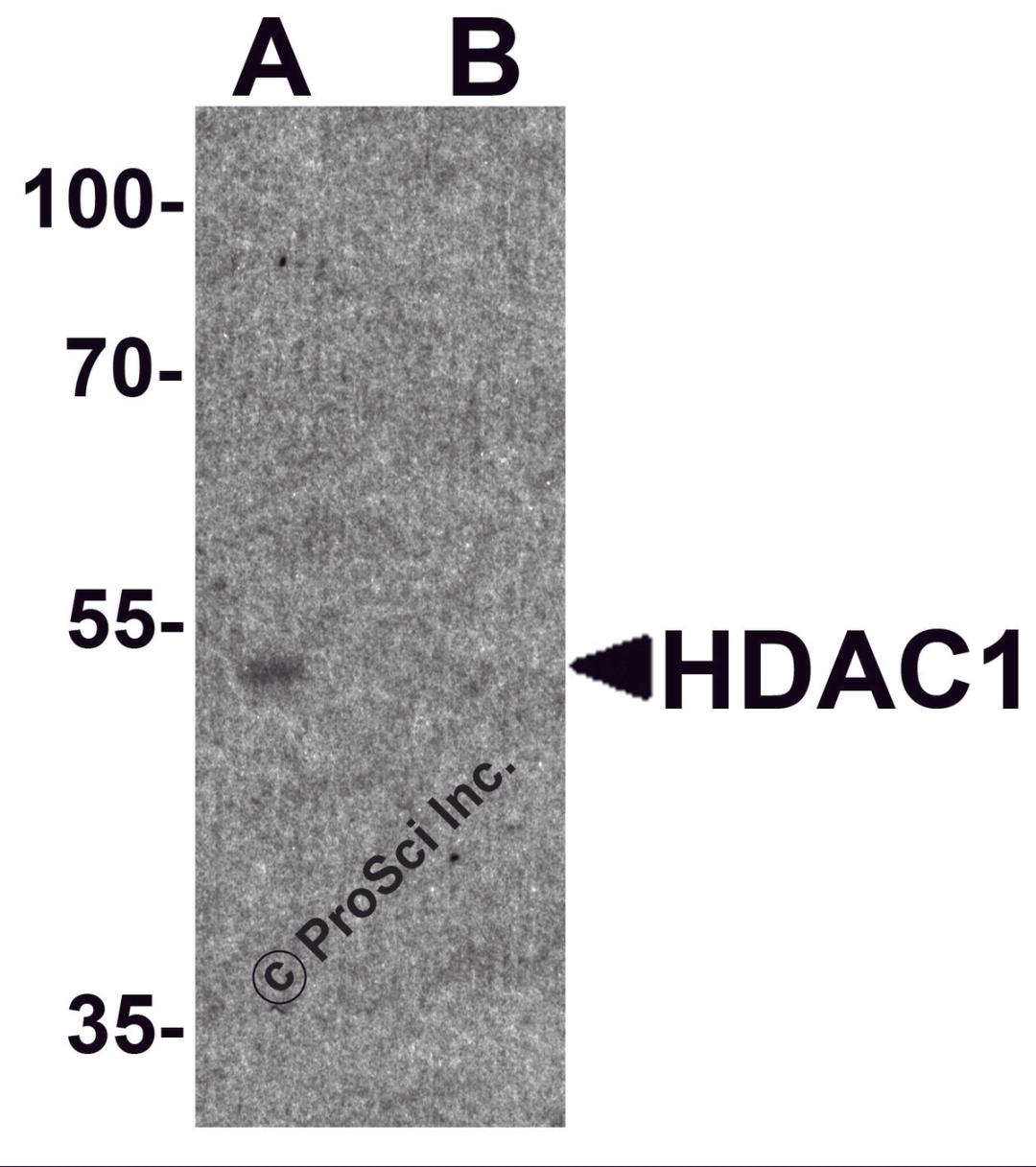 Western blot analysis of HDAC1 in human brain tissue lysate with HDAC1 antibody at 1μg/ml in (A) the absence and (B) the presence of blocking peptide.
