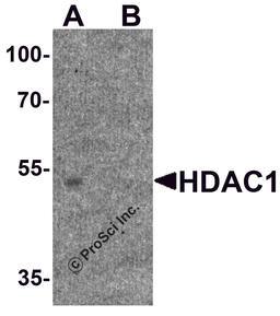 Western blot analysis of HDAC1 in human brain tissue lysate with HDAC1 antibody at 1μg/ml in (A) the absence and (B) the presence of blocking peptide.