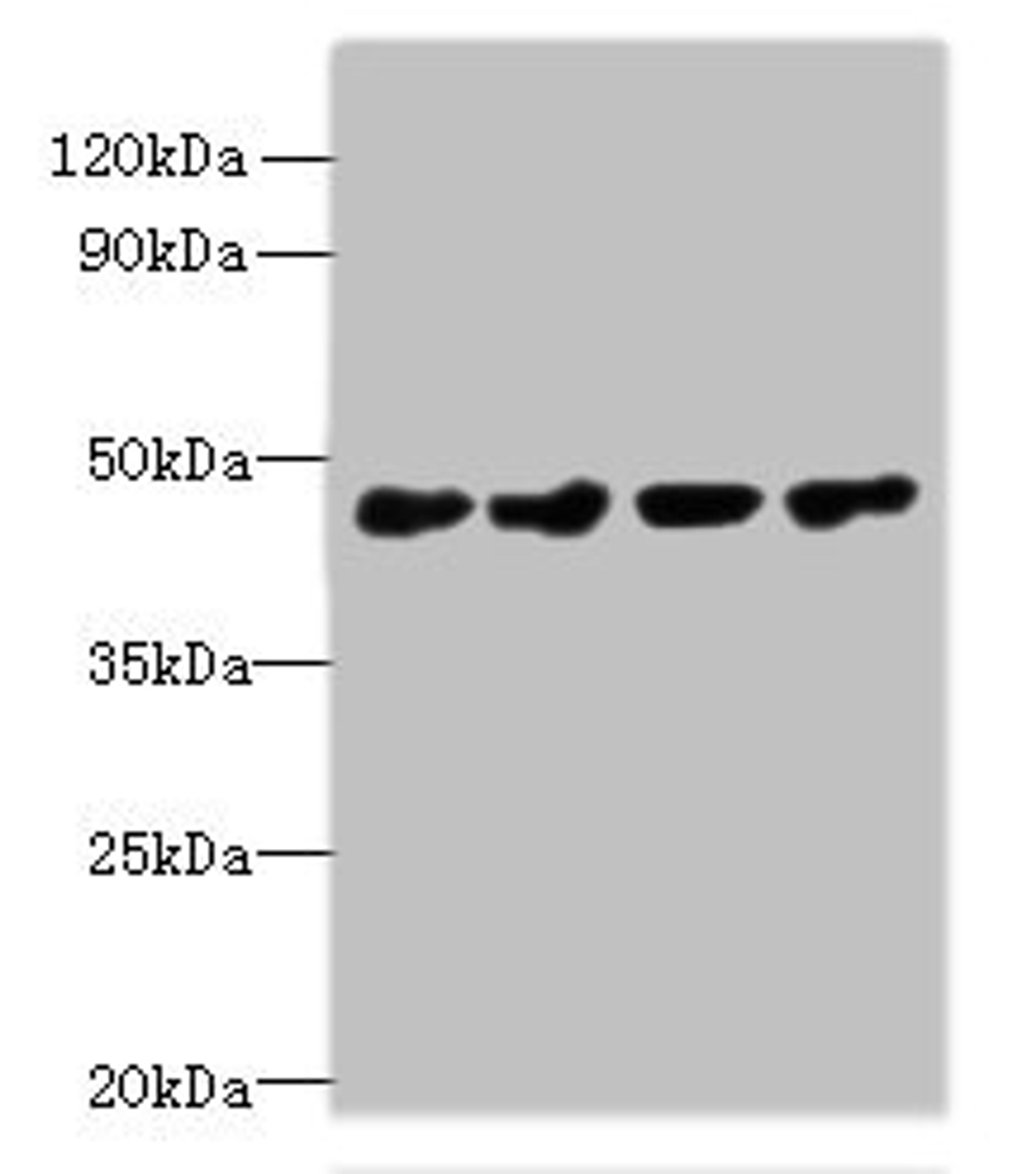Western blot. All lanes: PRMT6 antibody at 0.4ug/ml. Lane 1: 293T whole cell lysate. Lane 2: MCF-7 whole cell lysate. Lane 3: A431 whole cell lysate. Lane 4: K562 whole cell lysate. Secondary. Goat polyclonal to rabbit IgG at 1/10000 dilution. Predicted band size: 42, 33 kDa. Observed band size: 42 kDa. 