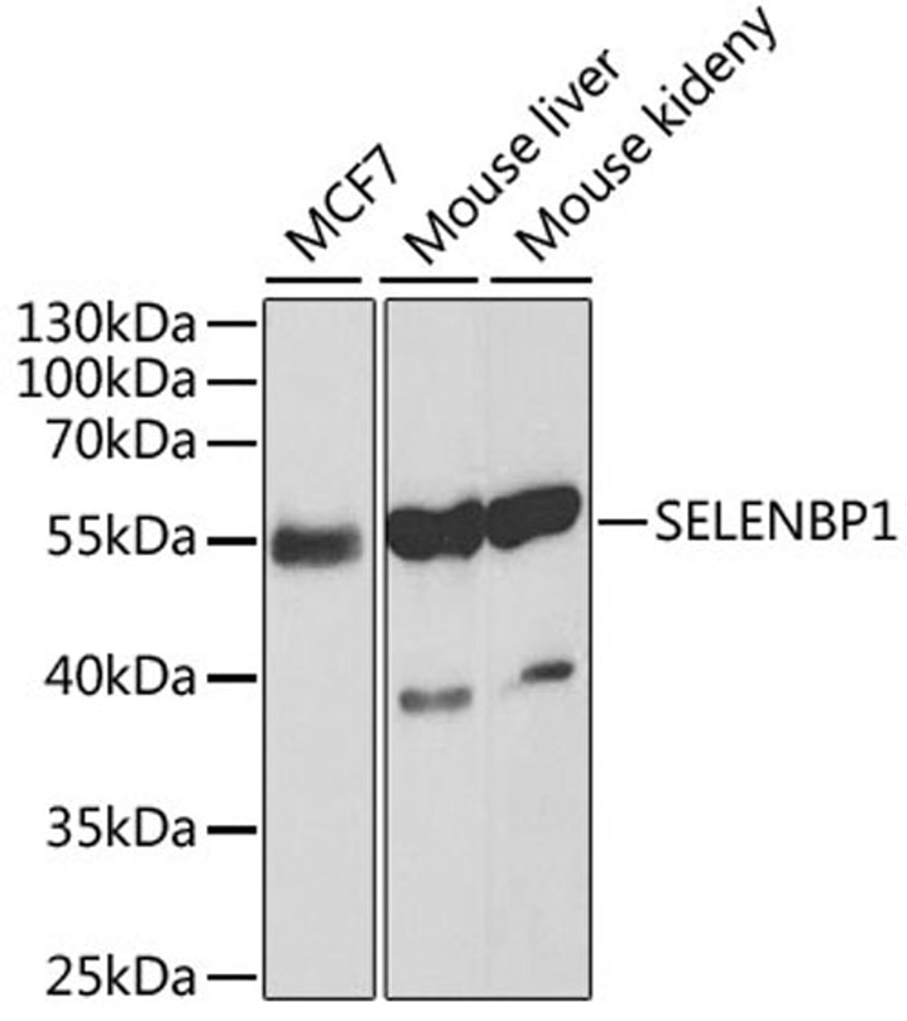 Western blot - SELENBP1 antibody (A1222)