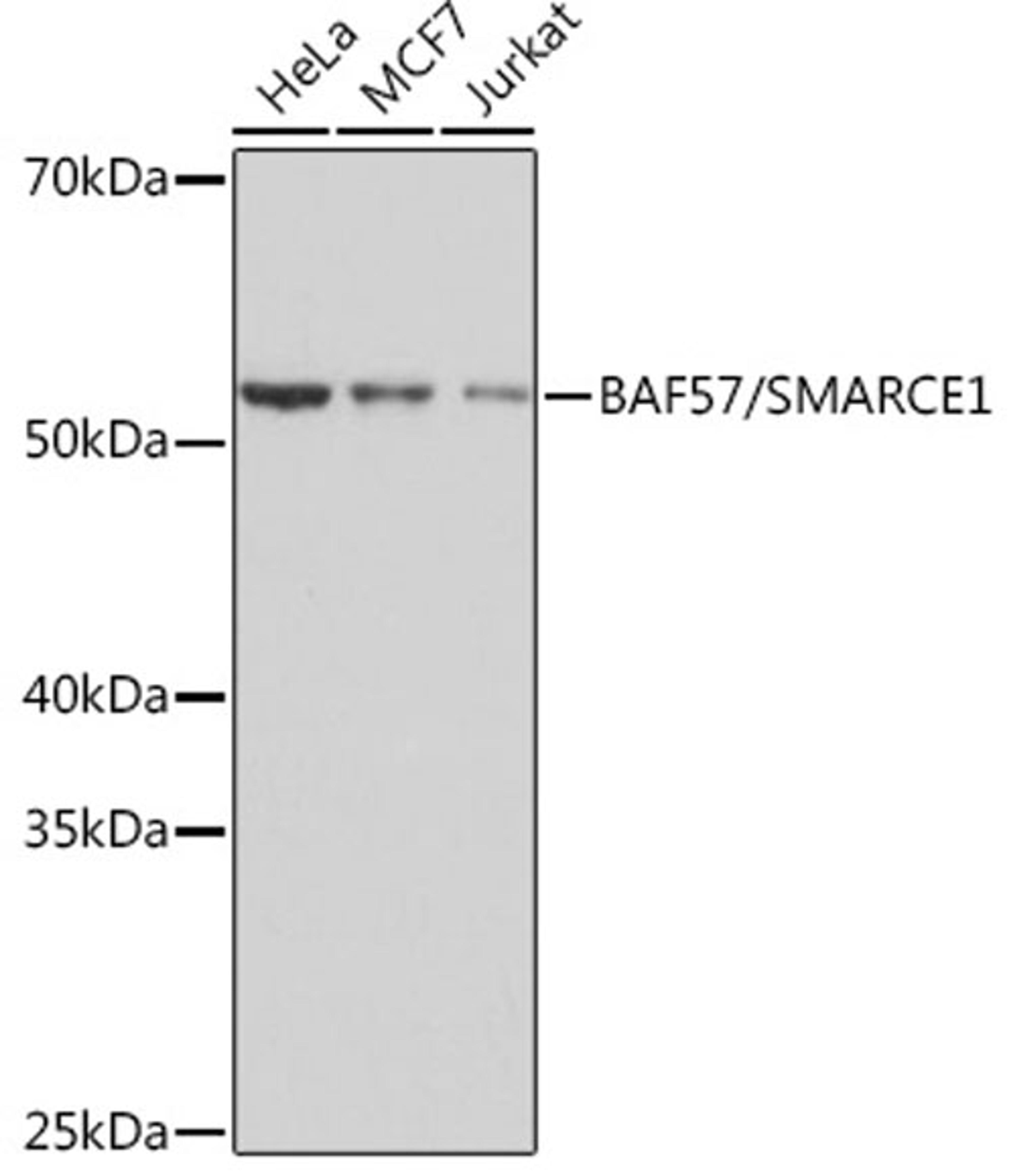 Western blot - BAF57/SMARCE1 Rabbit mAb (A3814)