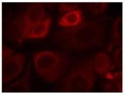 Immunocytochemistry/Immunofluorescence: ErbB3/Her3 [p Tyr1328] Antibody [NBP1-04970] - Immunofluorescence staingin of methanol-fixed MCF7 cells using ErbB3 (phospho-Tyr1328) Antibody.