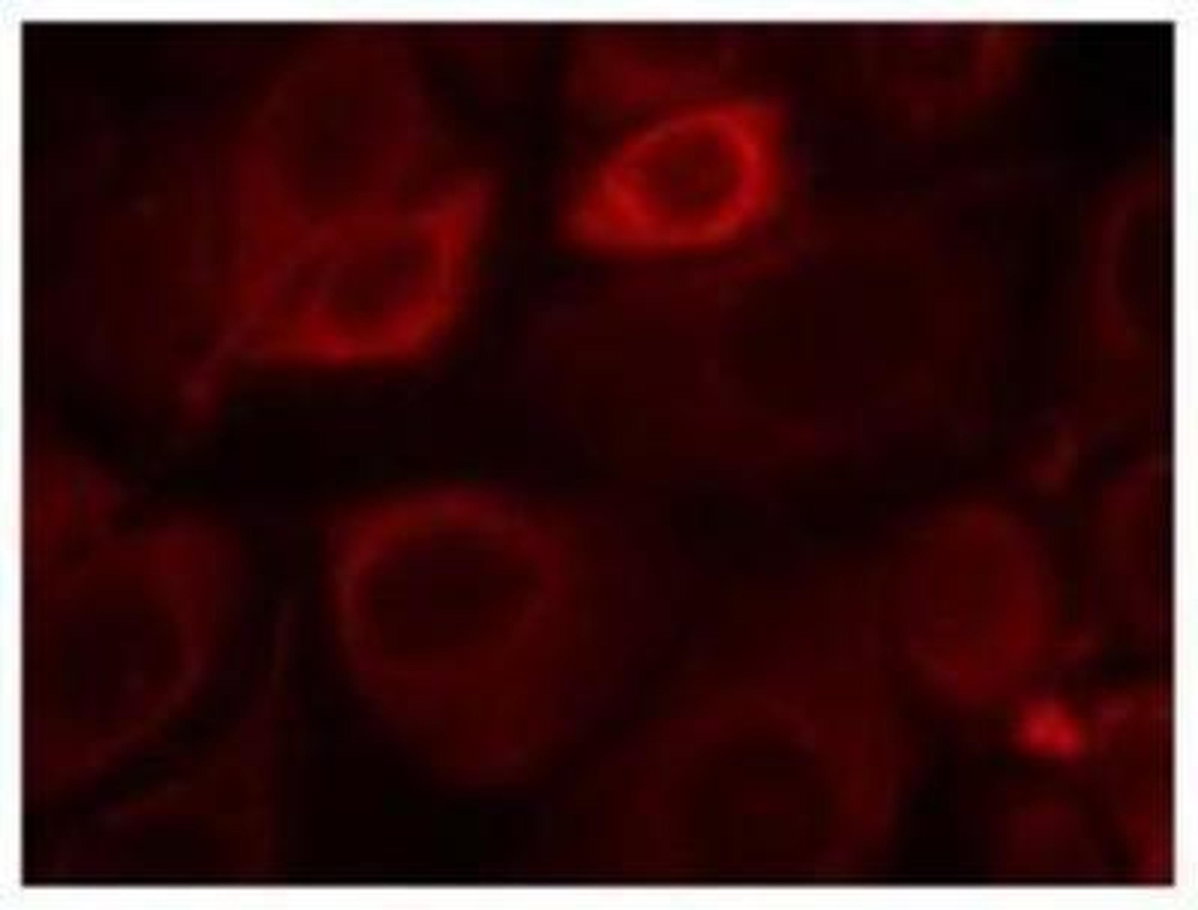 Immunocytochemistry/Immunofluorescence: ErbB3/Her3 [p Tyr1328] Antibody [NBP1-04970] - Immunofluorescence staingin of methanol-fixed MCF7 cells using ErbB3 (phospho-Tyr1328) Antibody.