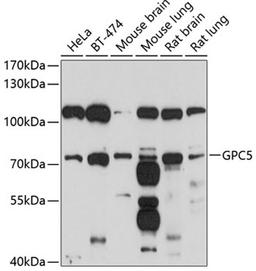 Western blot - GPC5 antibody (A10411)