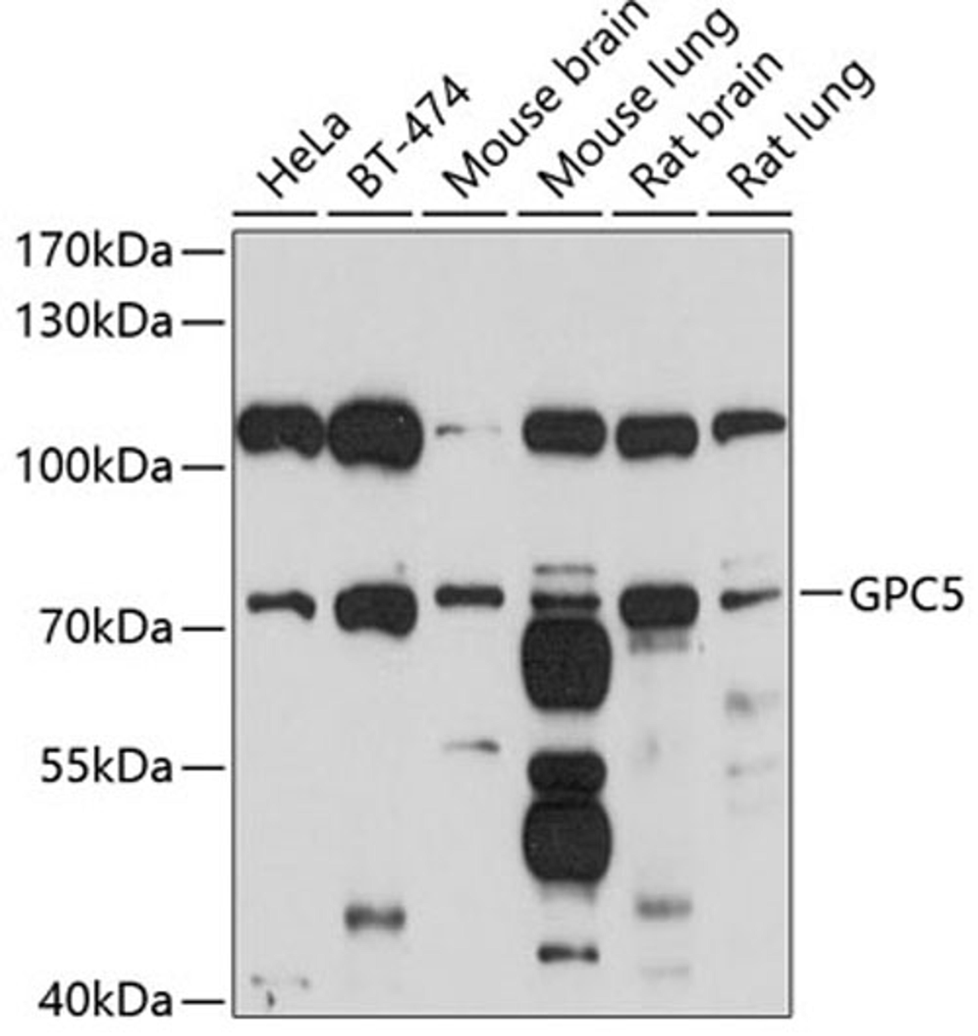 Western blot - GPC5 antibody (A10411)