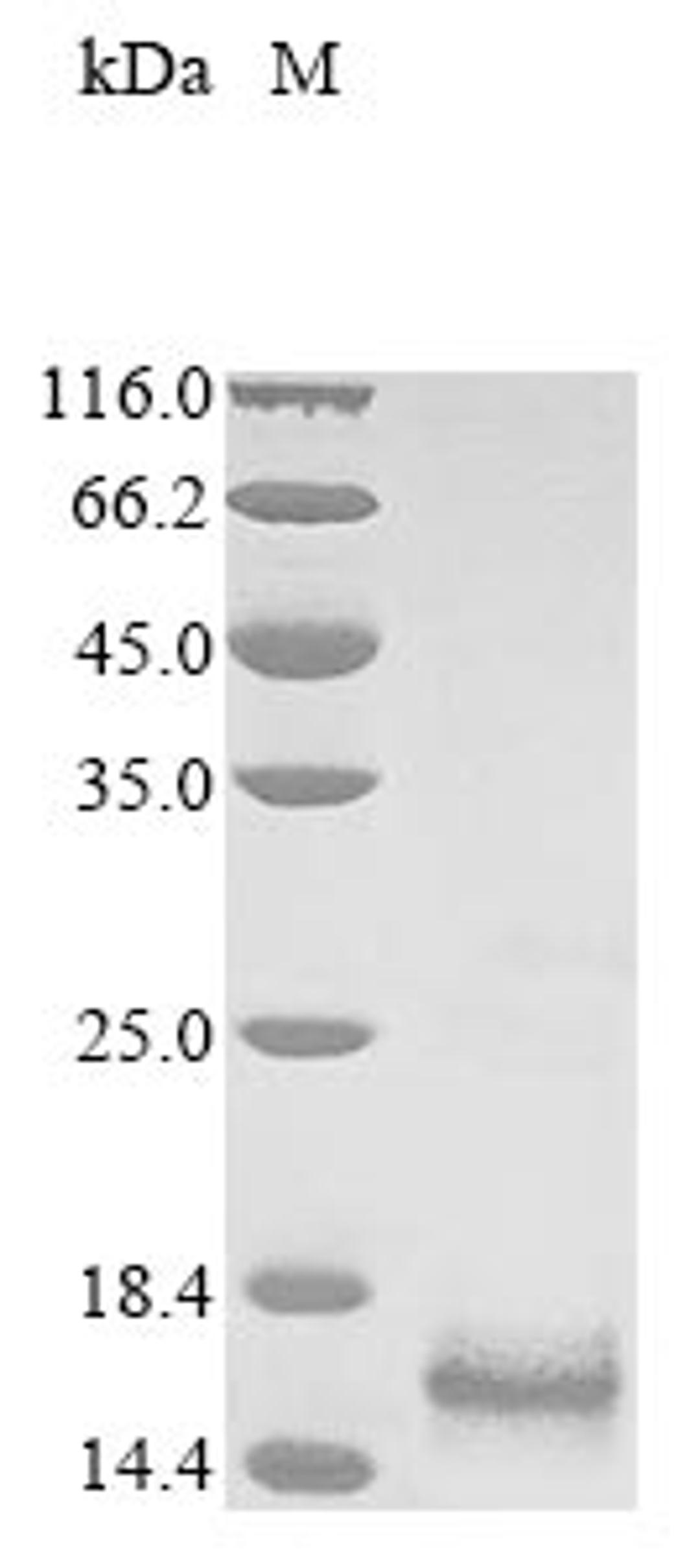 (Tris-Glycine gel) Discontinuous SDS-PAGE (reduced) with 5% enrichment gel and 15% separation gel.