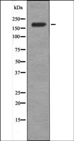 Western blot analysis of EGF treated A431 whole cell lysates using BRCA1 -Phospho-Ser1387- antibody