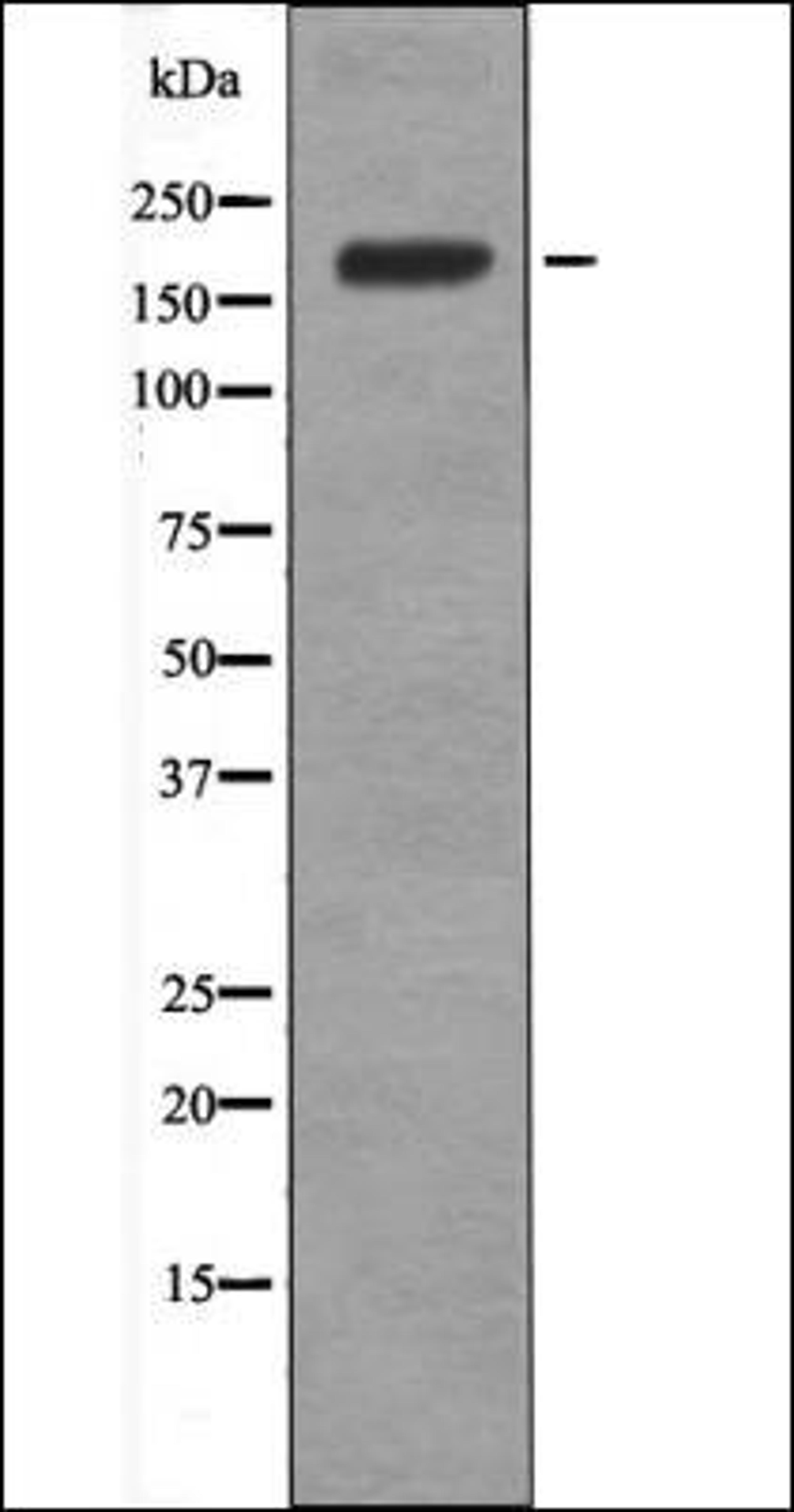 Western blot analysis of EGF treated A431 whole cell lysates using BRCA1 -Phospho-Ser1387- antibody