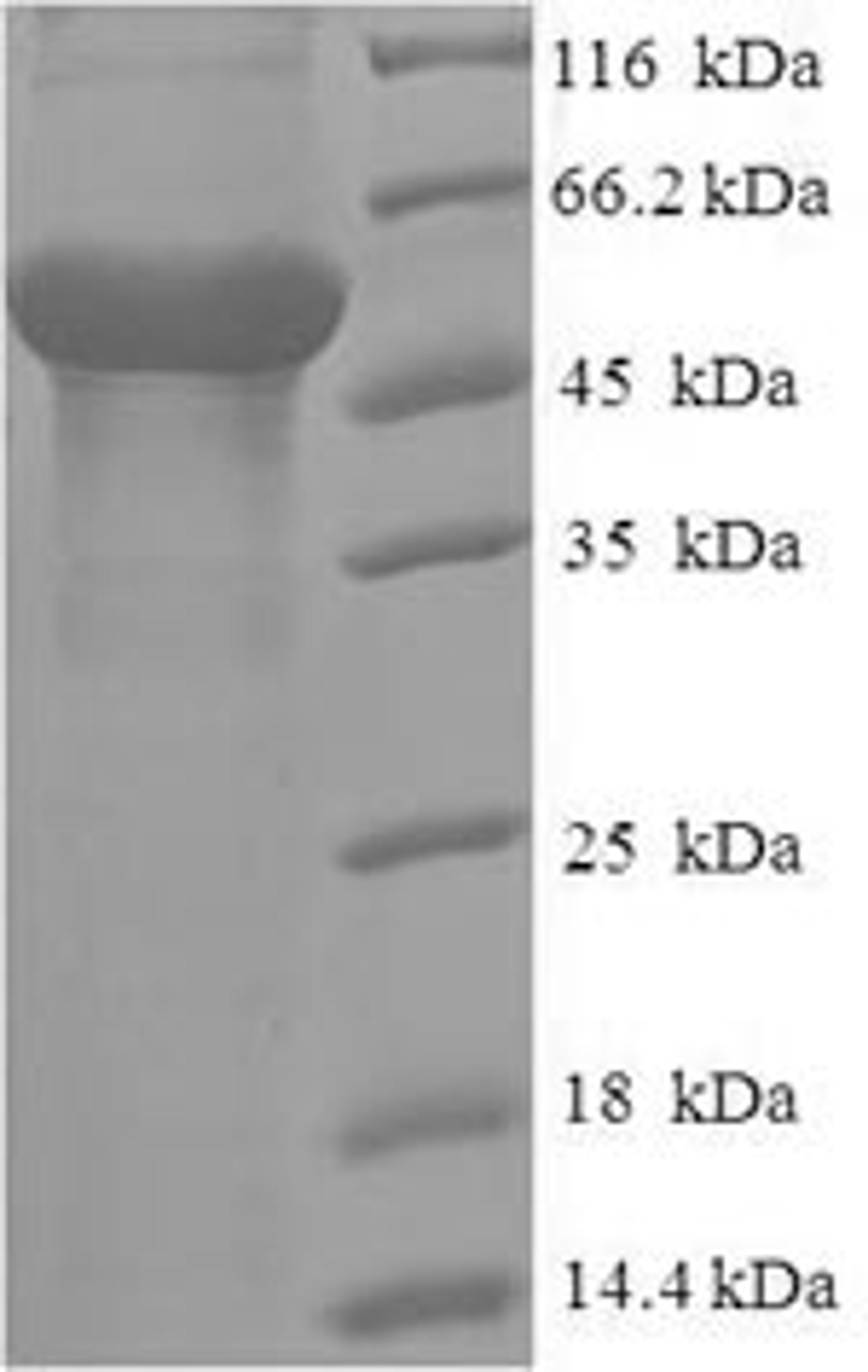 (Tris-Glycine gel) Discontinuous SDS-PAGE (reduced) with 5% enrichment gel and 15% separation gel.