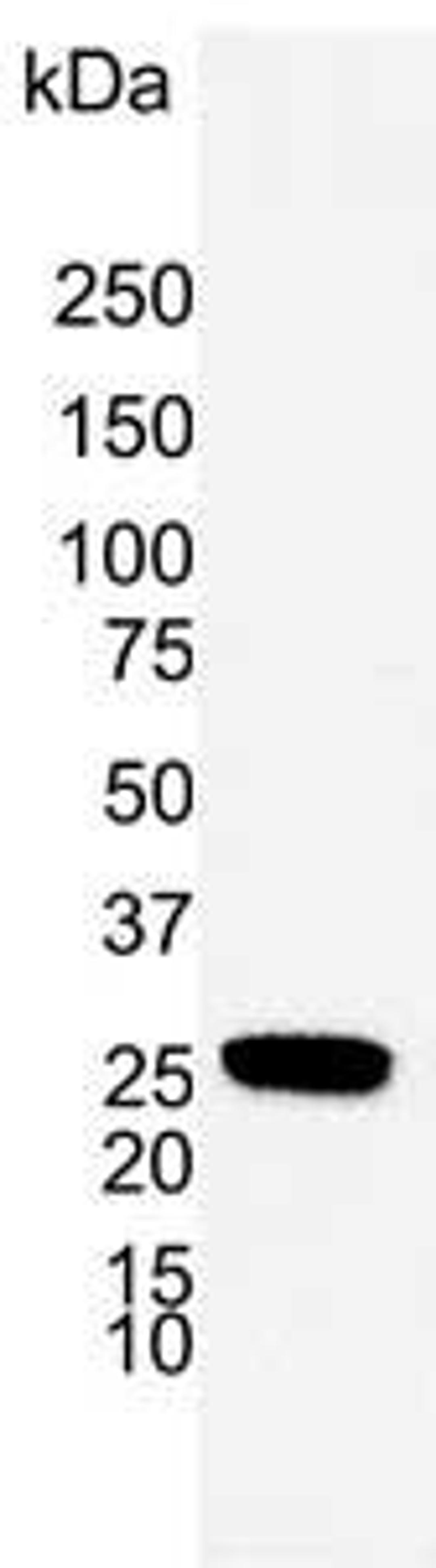 Western blot analysis of A549 human alveolar adenocarcinoma whole cell lysate
