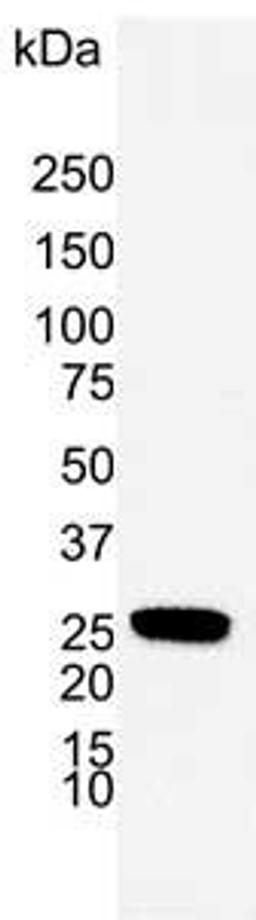 Western blot analysis of A549 human alveolar adenocarcinoma whole cell lysate
