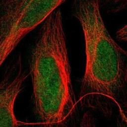 Immunocytochemistry/Immunofluorescence: LMW-PTP/ACP1 Antibody [NBP1-89551] - Staining of human cell line U-2 OS shows positivity in nucleus & cytoplasm.