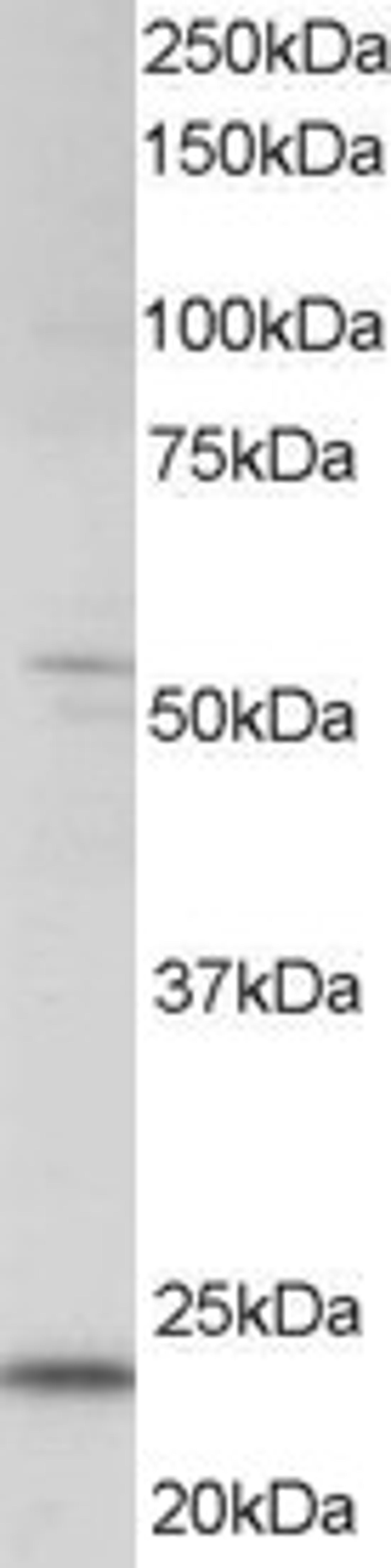 45-855 staining (0.5ug/ml) of human kidney lysate (RIPA buffer, 35ug total protein per lane). Primary incubated for 1 hour. Detected by western blot using chemiluminescence.