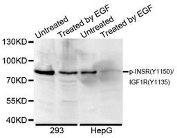 Western blot analysis of extracts of various cell lines using Insulin Receptor beta (phospho-Y1189) antibody