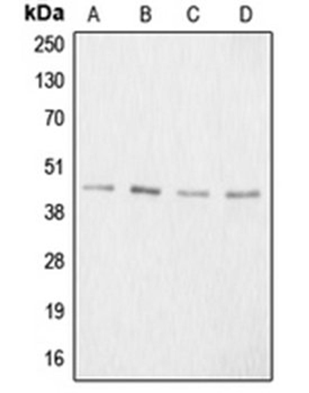 Western blot analysis of HeLa colchicine-treated (Lane 1), mouse kidney (Lane 2), PC12 colchicine-treated (Lane 3), NIH3T3 (Lane 4) whole cell lysates using ACAN antibody