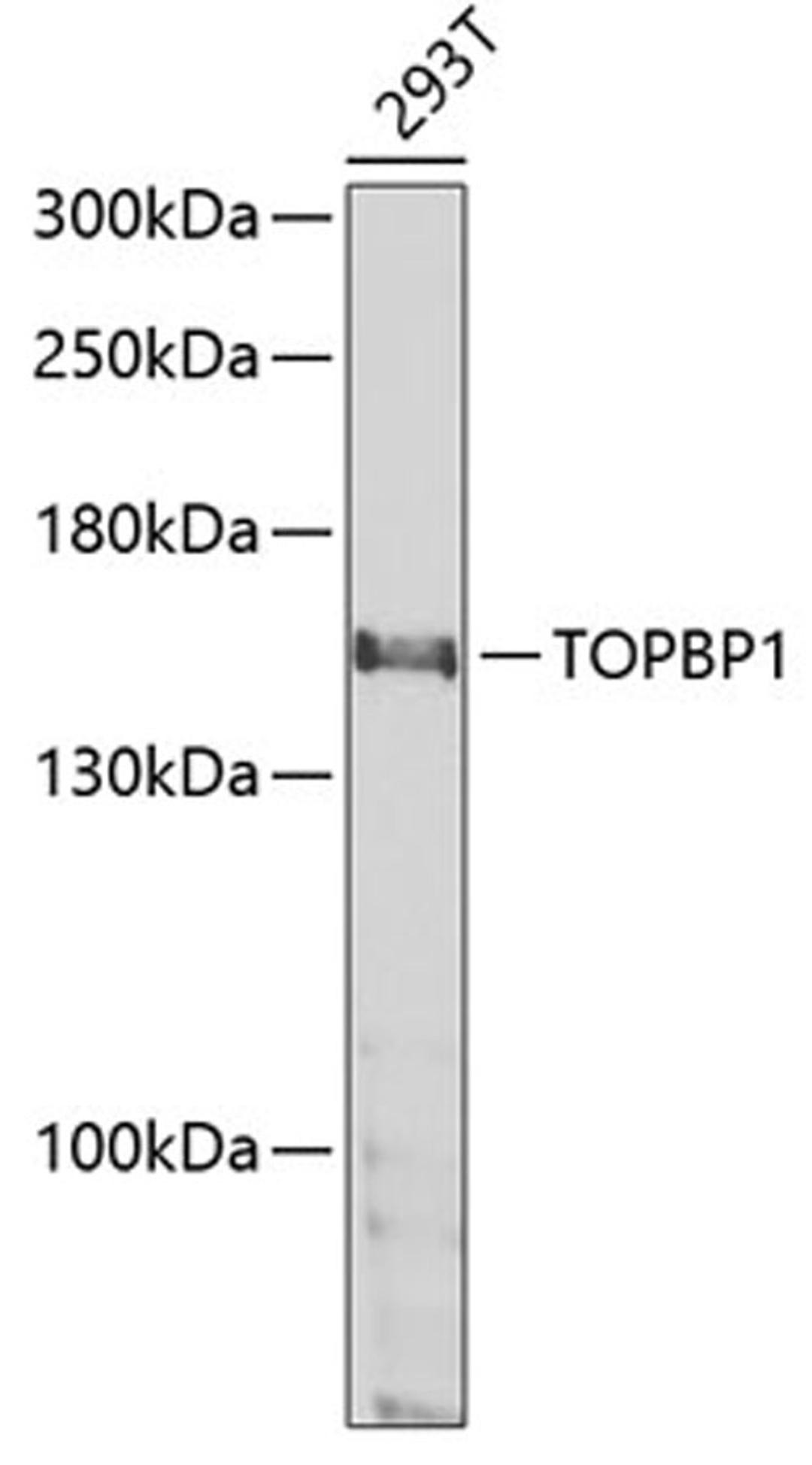 Western blot - TOPBP1 antibody (A5781)