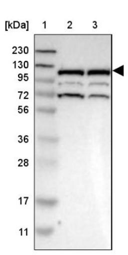 Western Blot: RASGRF2 Antibody [NBP1-83331] - Lane 1: Marker [kDa] 230, 130, 95, 72, 56, 36, 28, 17, 11<br/>Lane 2: Human cell line RT-4<br/>Lane 3: Human cell line U-251MG sp