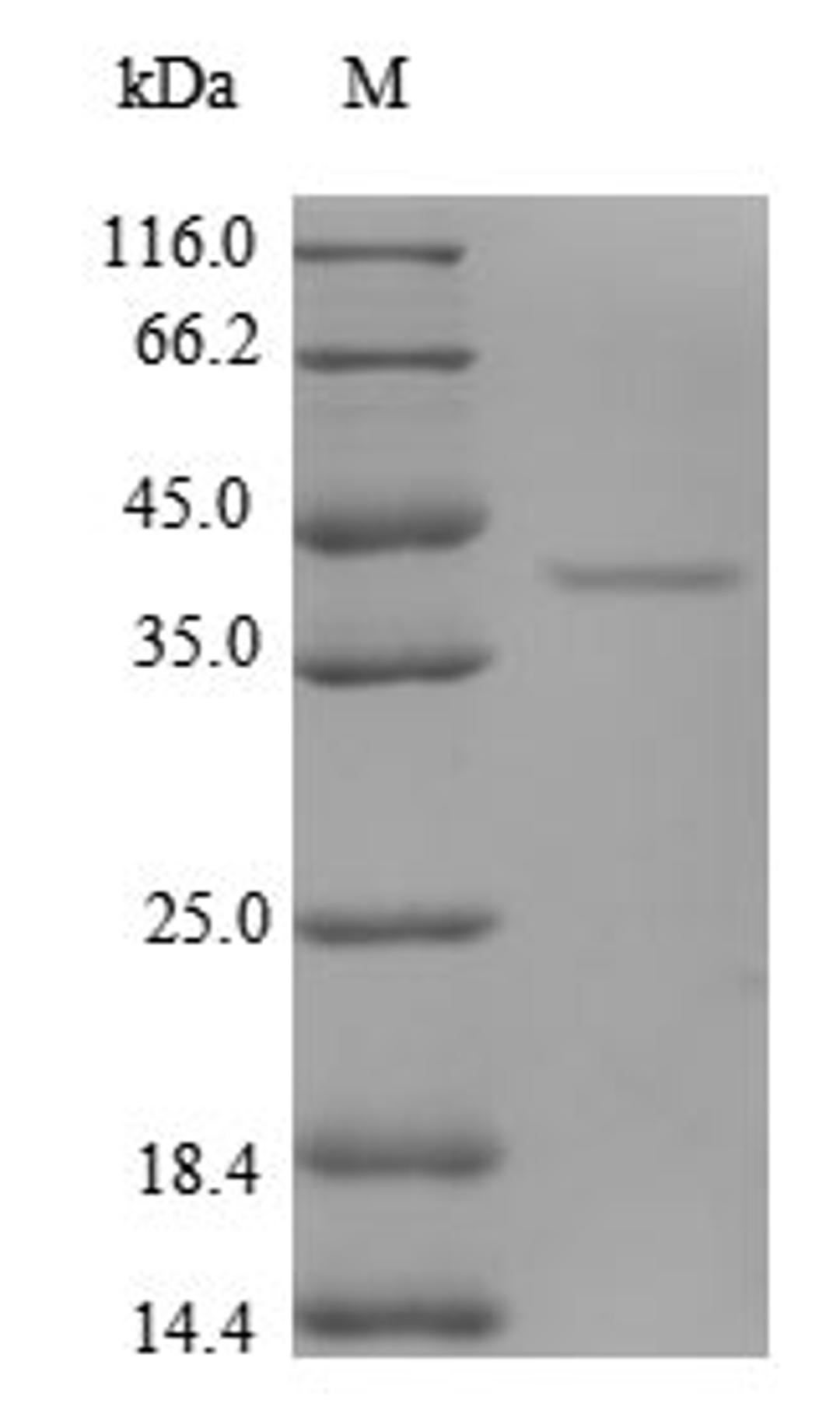 (Tris-Glycine gel) Discontinuous SDS-PAGE (reduced) with 5% enrichment gel and 15% separation gel.