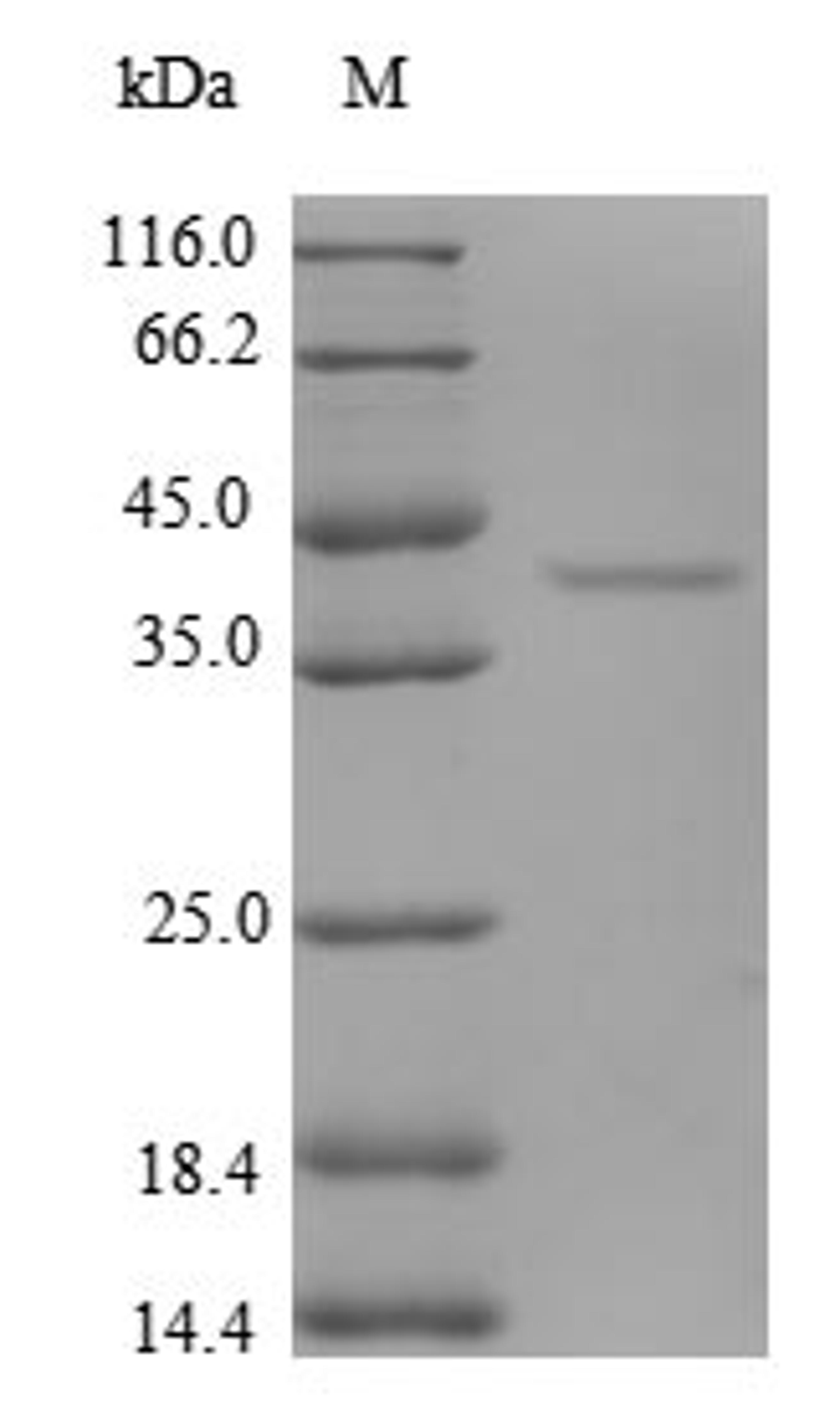 (Tris-Glycine gel) Discontinuous SDS-PAGE (reduced) with 5% enrichment gel and 15% separation gel.