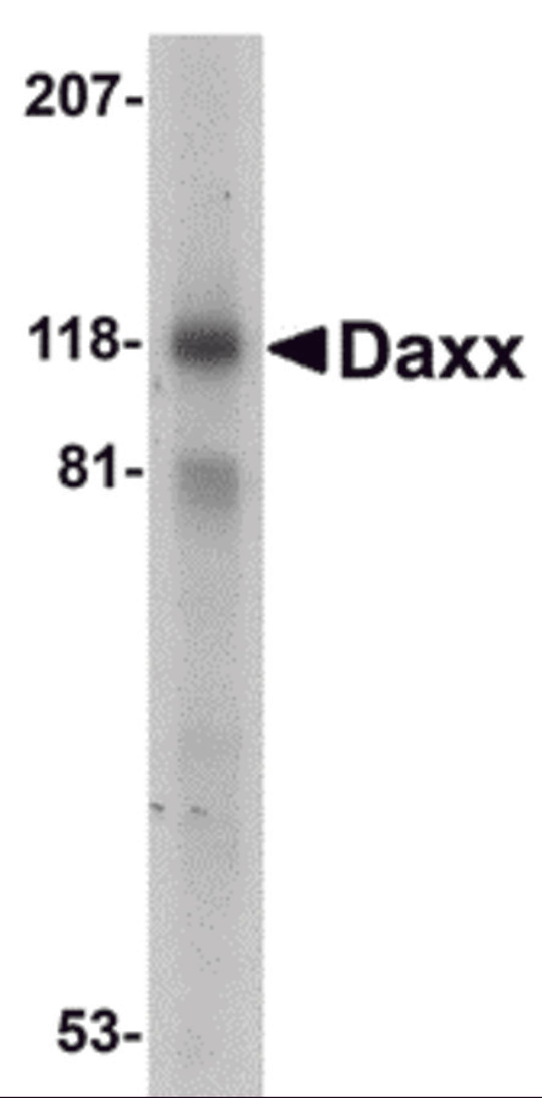 Western blot analysis of Daxx in 293 total cell lysate with Dax antibody at 1 mg/mL. 