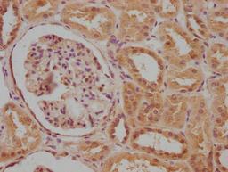IHC image of CSB-PA004398LA01HU diluted at 1:100 and staining in paraffin-embedded human kidney tissue performed on a Leica BondTM system. After dewaxing and hydration, antigen retrieval was mediated by high pressure in a citrate buffer (pH 6.0). Section was blocked with 10% normal goat serum 30min at RT. Then primary antibody (1% BSA) was incubated at 4°C overnight. The primary is detected by a biotinylated secondary antibody and visualized using an HRP conjugated SP system.