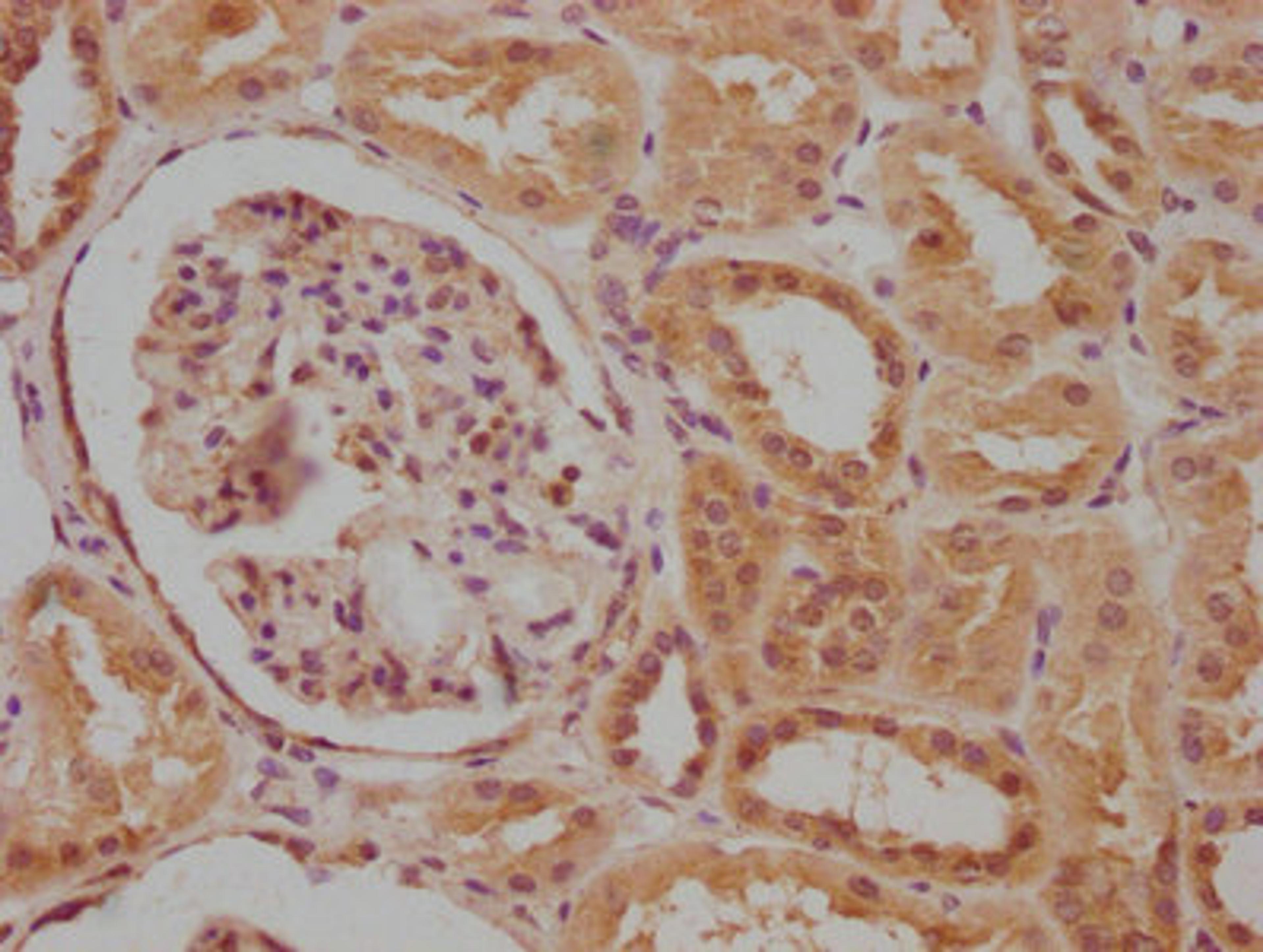 IHC image of CSB-PA004398LA01HU diluted at 1:100 and staining in paraffin-embedded human kidney tissue performed on a Leica BondTM system. After dewaxing and hydration, antigen retrieval was mediated by high pressure in a citrate buffer (pH 6.0). Section was blocked with 10% normal goat serum 30min at RT. Then primary antibody (1% BSA) was incubated at 4°C overnight. The primary is detected by a biotinylated secondary antibody and visualized using an HRP conjugated SP system.
