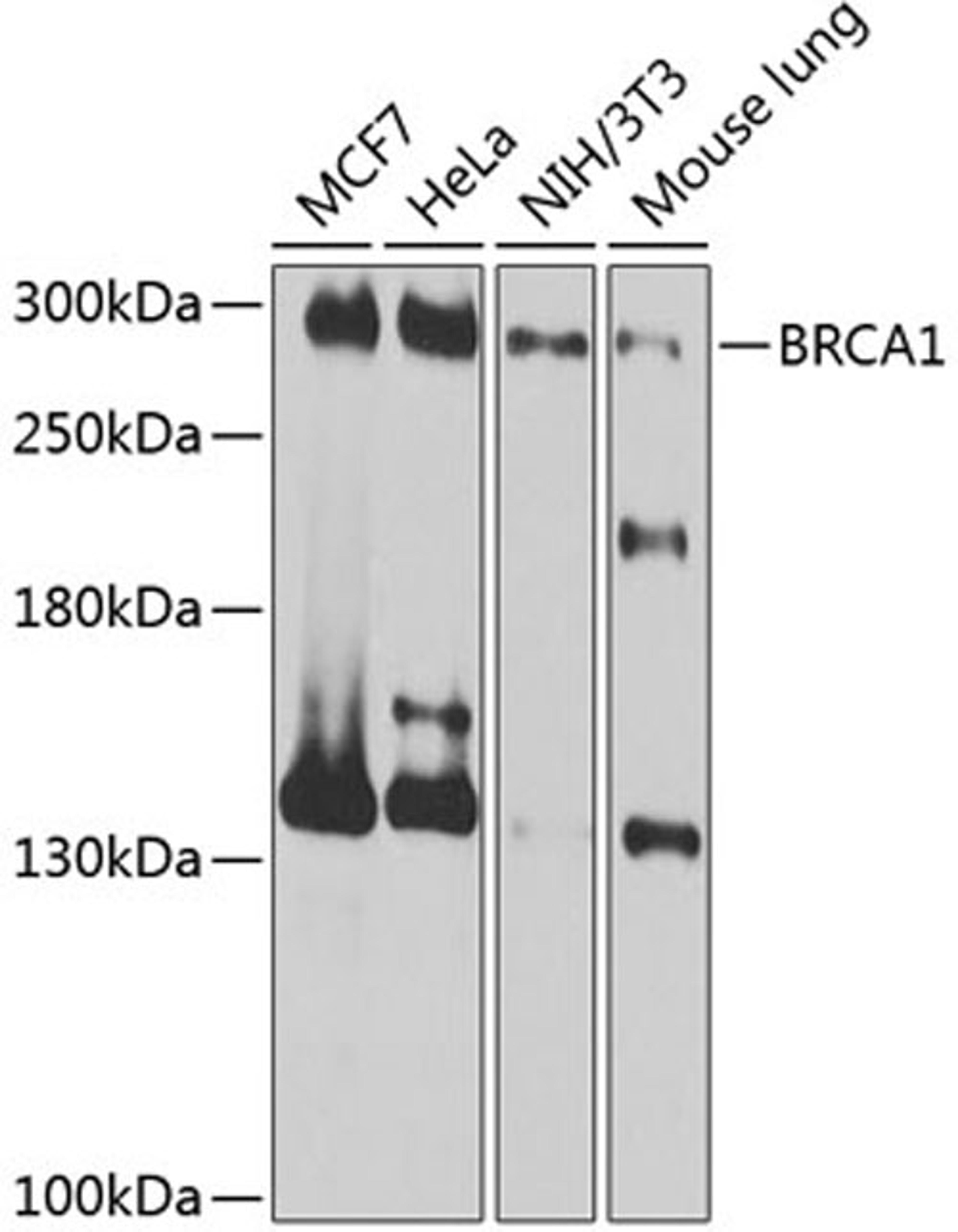 Western blot - BRCA1 antibody (A11549)