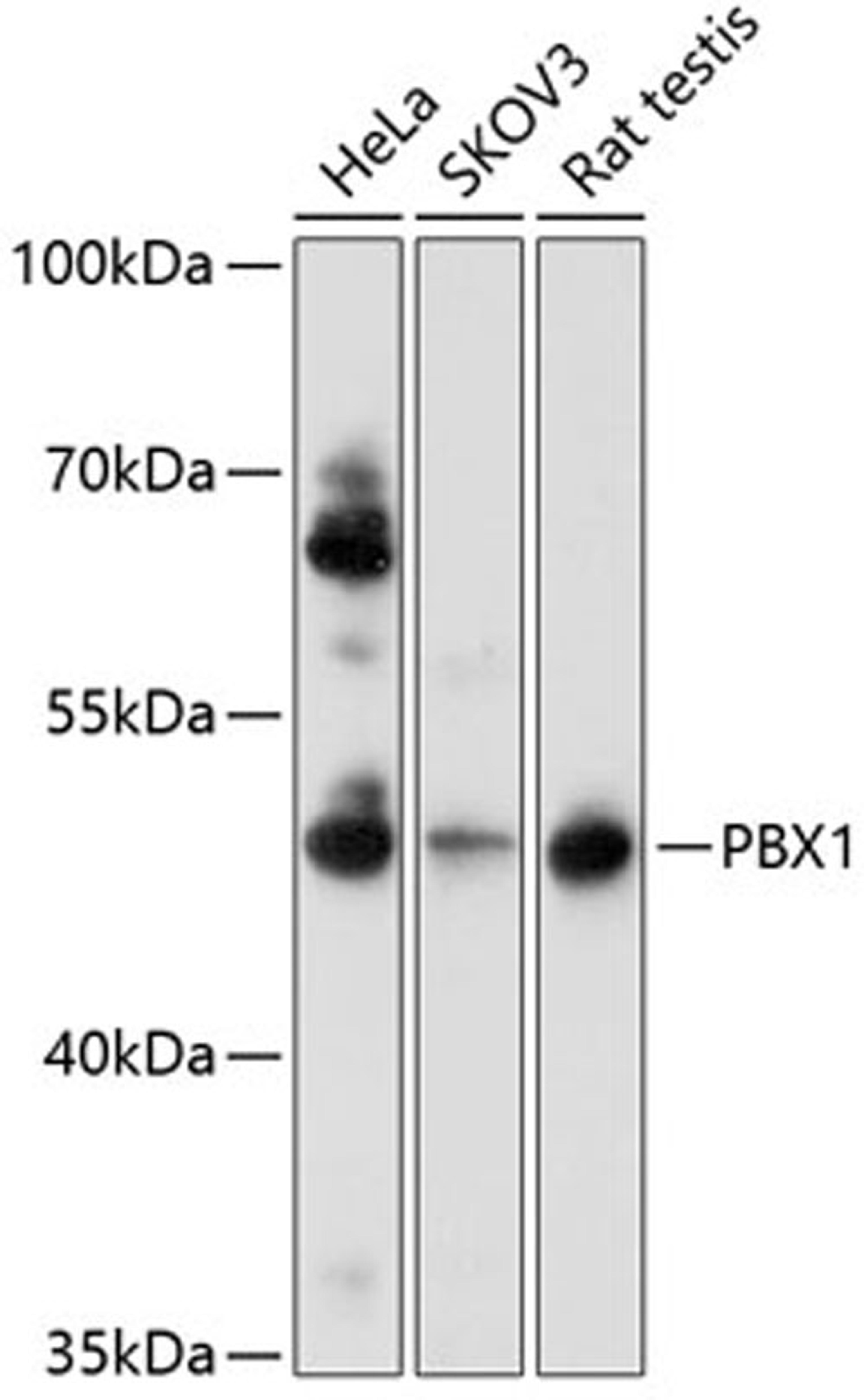 Western blot - PBX1 antibody (A0124)