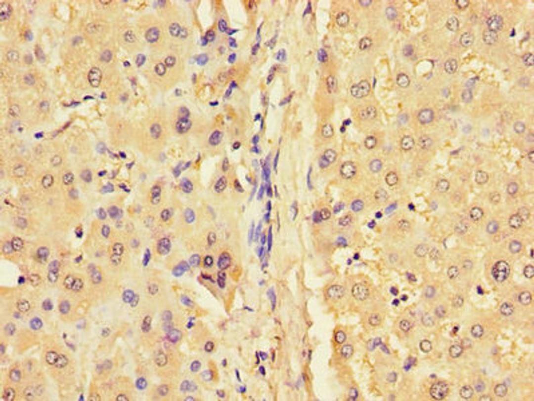 Immunohistochemistry of paraffin-embedded human liver tissue using CSB-PA009451LA01HU at dilution of 1:100