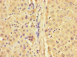 Immunohistochemistry of paraffin-embedded human liver tissue using CSB-PA009451LA01HU at dilution of 1:100