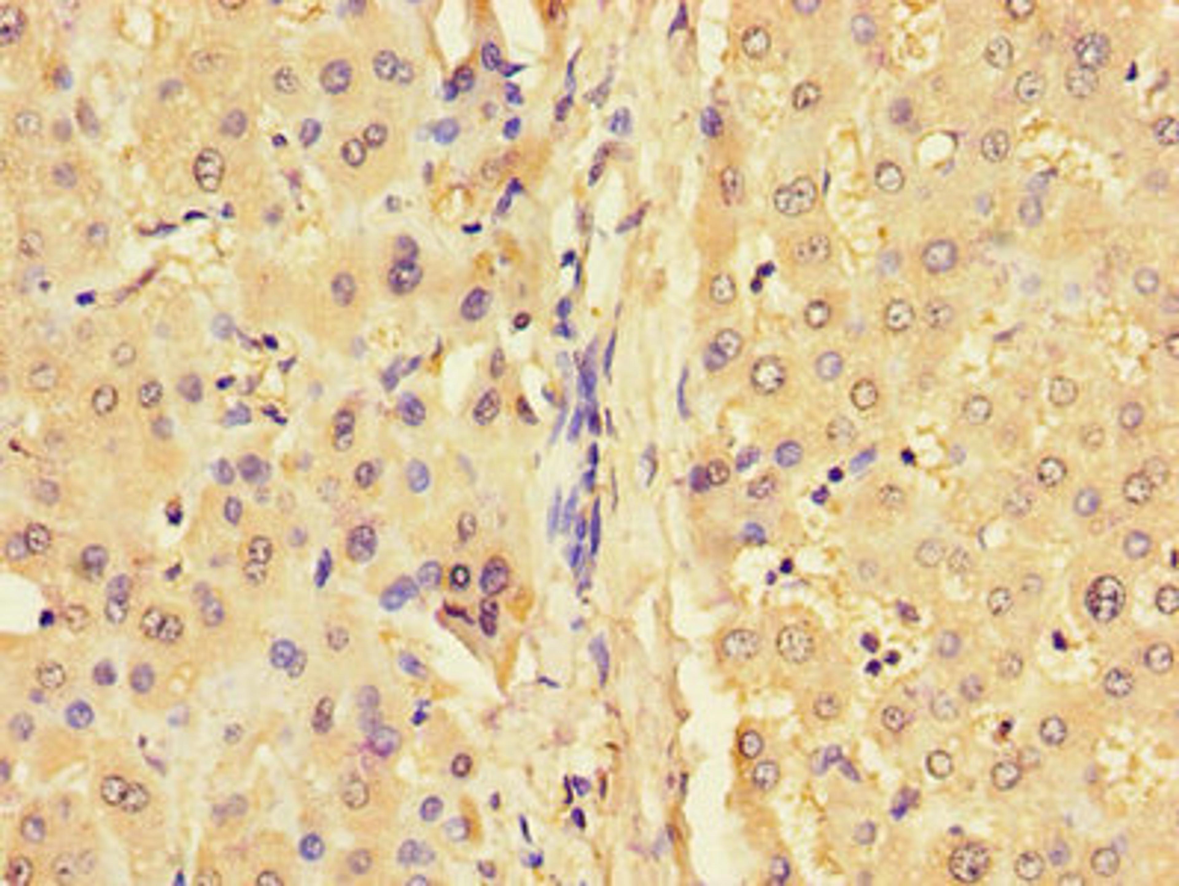 Immunohistochemistry of paraffin-embedded human liver tissue using CSB-PA009451LA01HU at dilution of 1:100