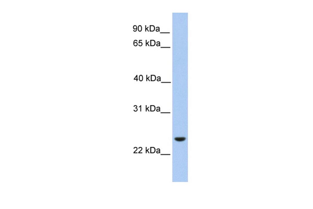 Antibody used in WB on Human HepG2 at 0.2-1 ug/ml.