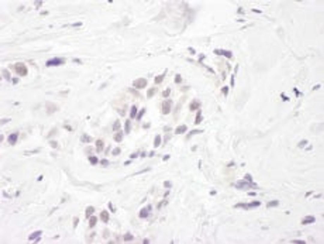 Detection of human RBM27 by immunohistochemistry.