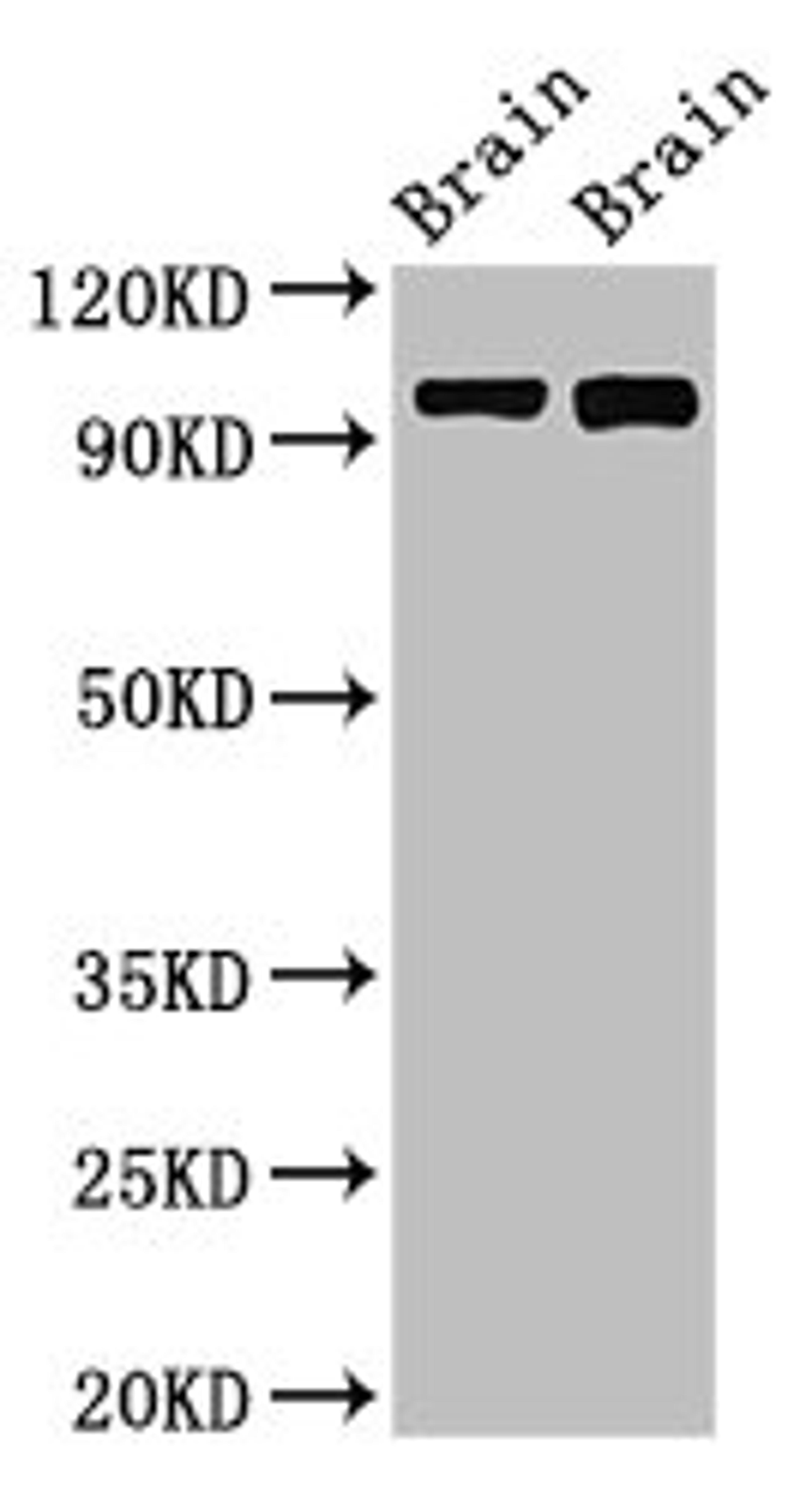 Western Blot. Positive WB detected in: Rat brain tissue, Mouse brain tissue. All lanes: ATP6V0A1 antibody at 3ug/ml. Secondary. Goat polyclonal to rabbit IgG at 1/50000 dilution. Predicted band size: 97, 96 kDa. Observed band size: 97 kDa. 