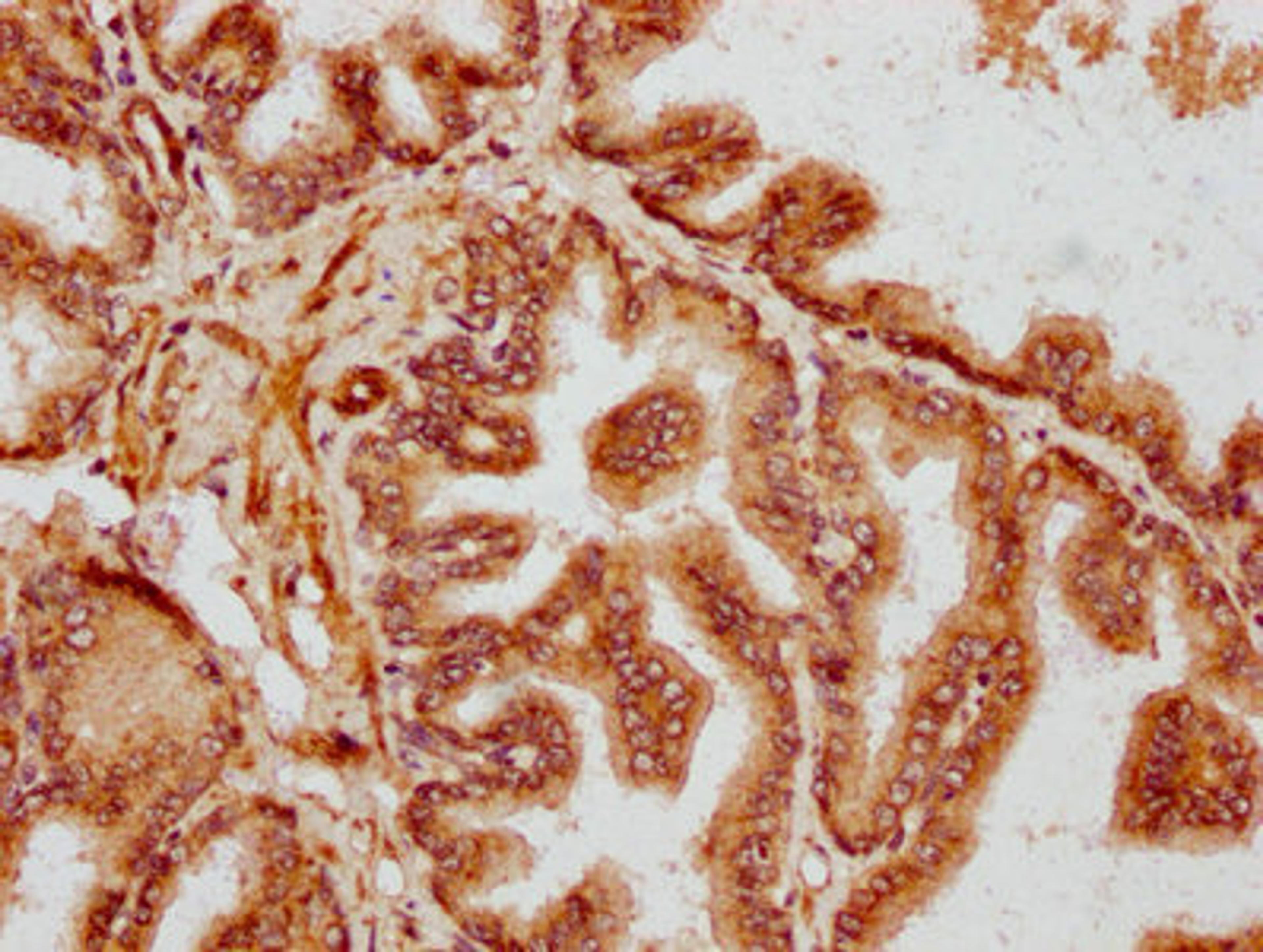 IHC image of CSB-PA622788LA01HU diluted at 1:300 and staining in paraffin-embedded human prostate tissue performed on a Leica BondTM system. After dewaxing and hydration, antigen retrieval was mediated by high pressure in a citrate buffer (pH 6.0). Section was blocked with 10% normal goat serum 30min at RT. Then primary antibody (1% BSA) was incubated at 4&deg;C overnight. The primary is detected by a biotinylated secondary antibody and visualized using an HRP conjugated SP system.