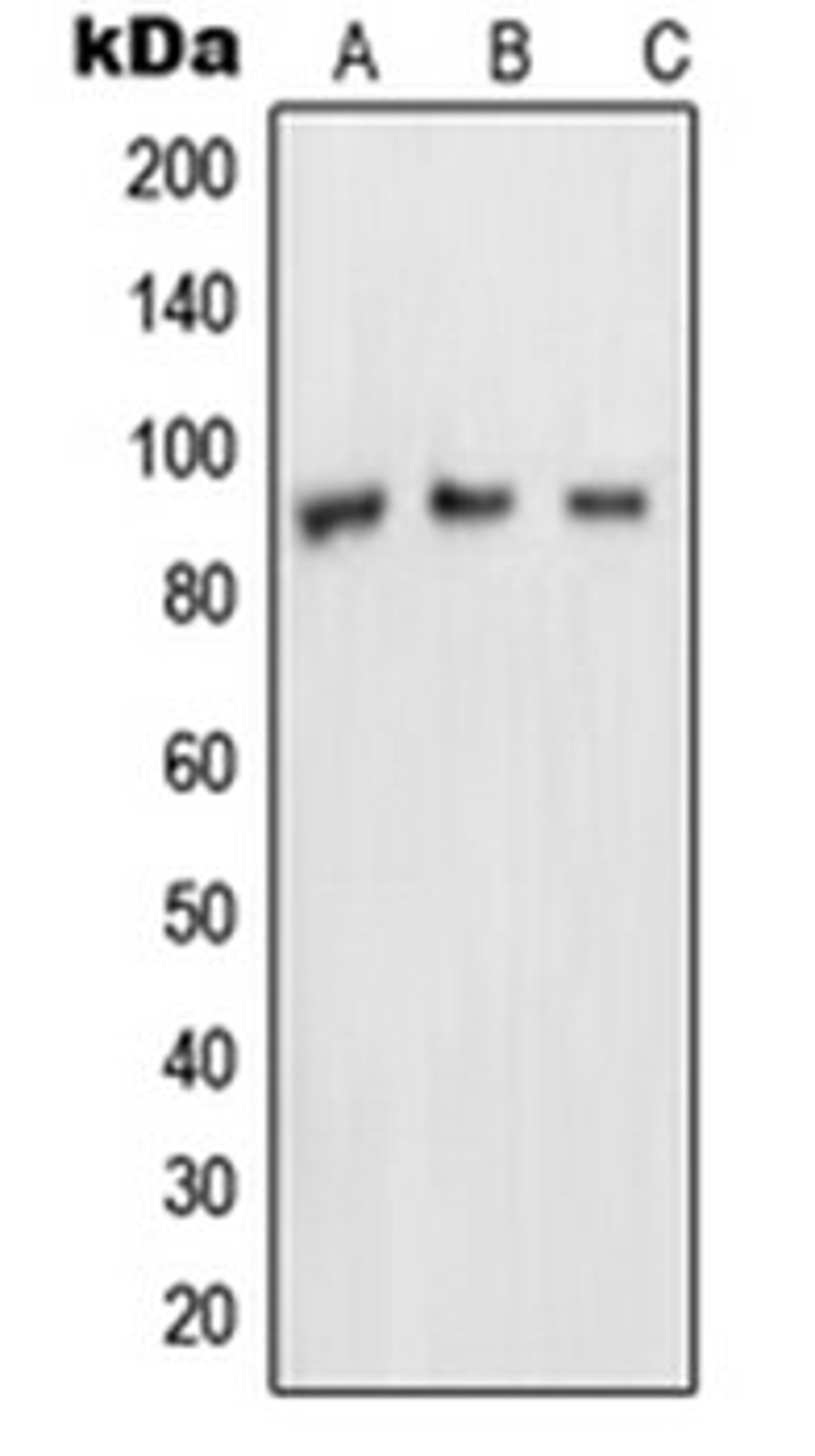 Western blot analysis of MDAMB453 (Lane 1), A431 (Lane 2), HeLa (Lane 3) whole cell lysates using NUP88 antibody