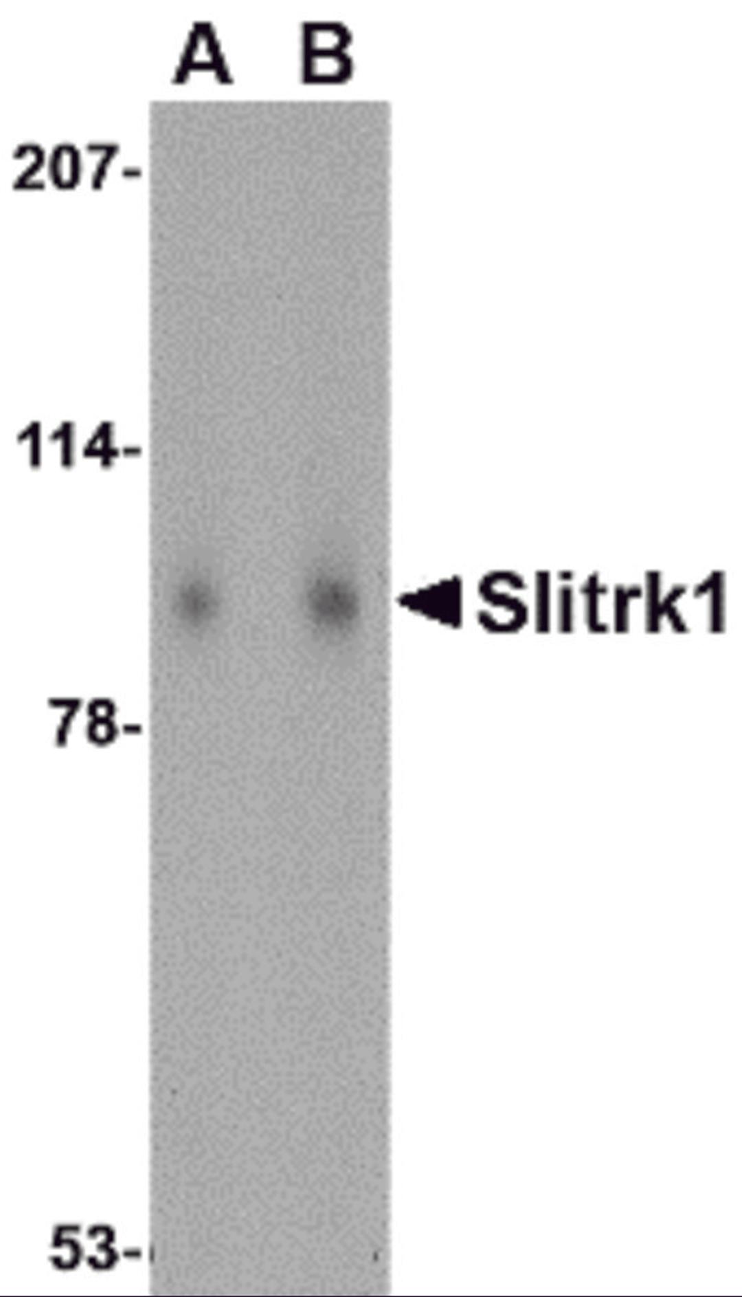 Western blot analysis of Slitrk1 in human brain tissue lysate with Slitrk1 antibody at (A) 1 and (B) 2 μg/mL.
