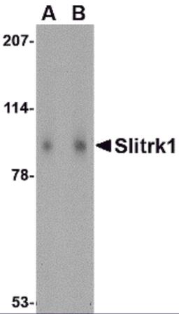 Western blot analysis of Slitrk1 in human brain tissue lysate with Slitrk1 antibody at (A) 1 and (B) 2 μg/mL.
