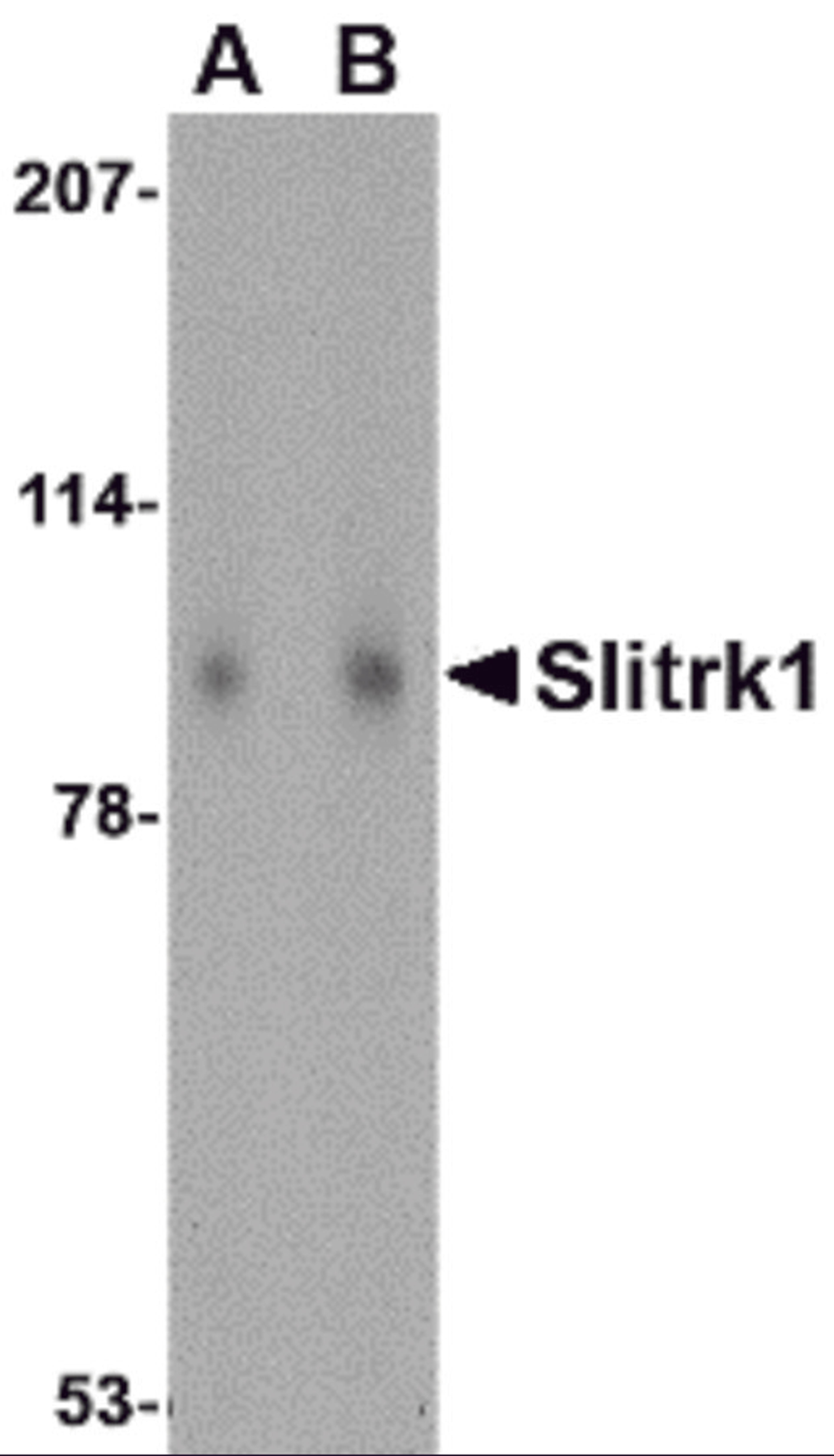 Western blot analysis of Slitrk1 in human brain tissue lysate with Slitrk1 antibody at (A) 1 and (B) 2 μg/mL.