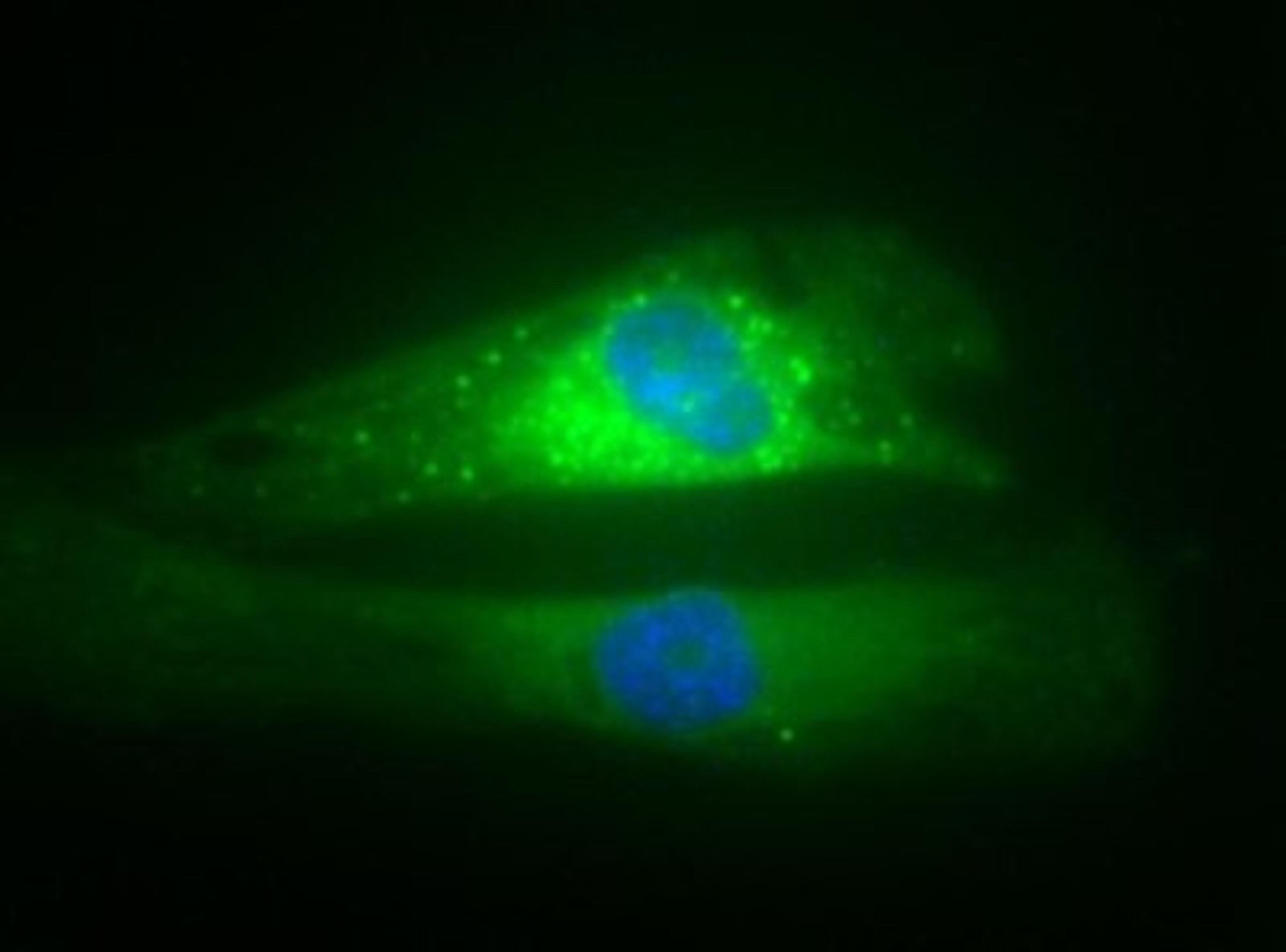 Immunocytochemistry/Immunofluorescence: p62/SQSTM1 Antibody [NBP1-48320] - Immunocytochemical analysis of SQSTM1/p62 in HeLa cells