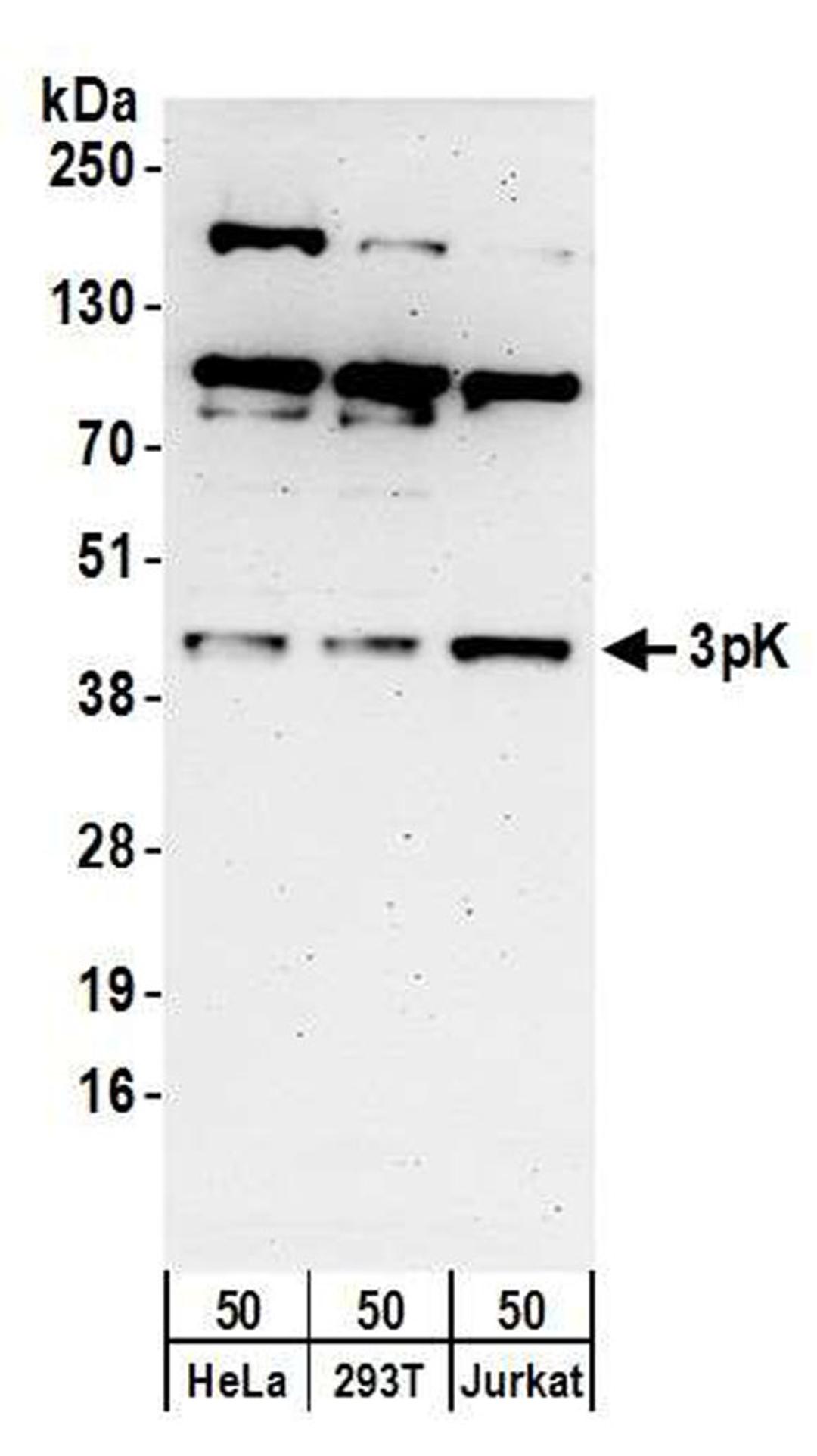 Detection of human 3pK by WB.