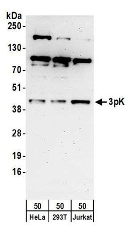 Detection of human 3pK by WB.