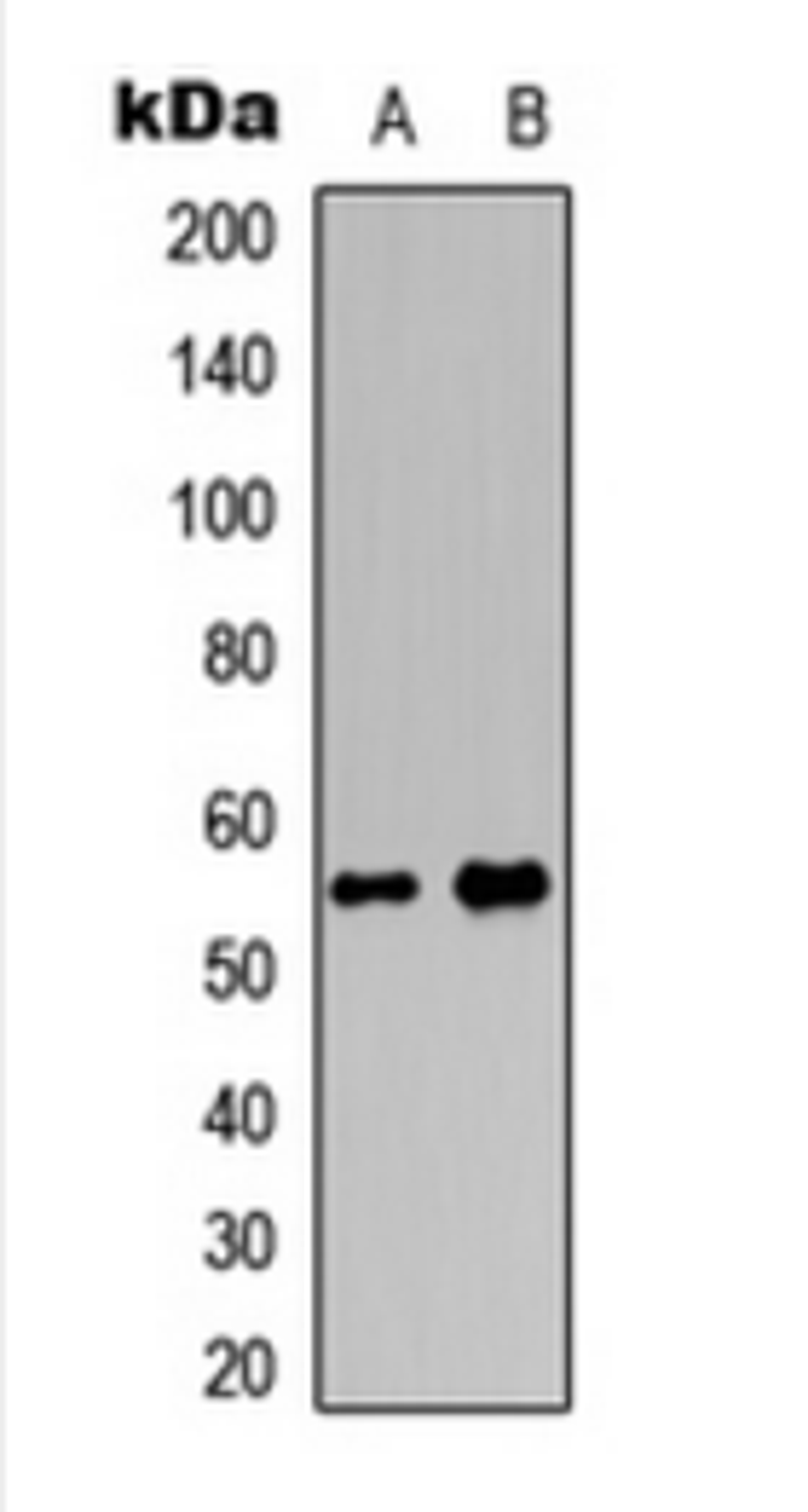 Western blot analysis of K562 (Lane 1), HepG2 (Lane 2) whole cell lysates using MEF2D (Phospho-S444) antibody