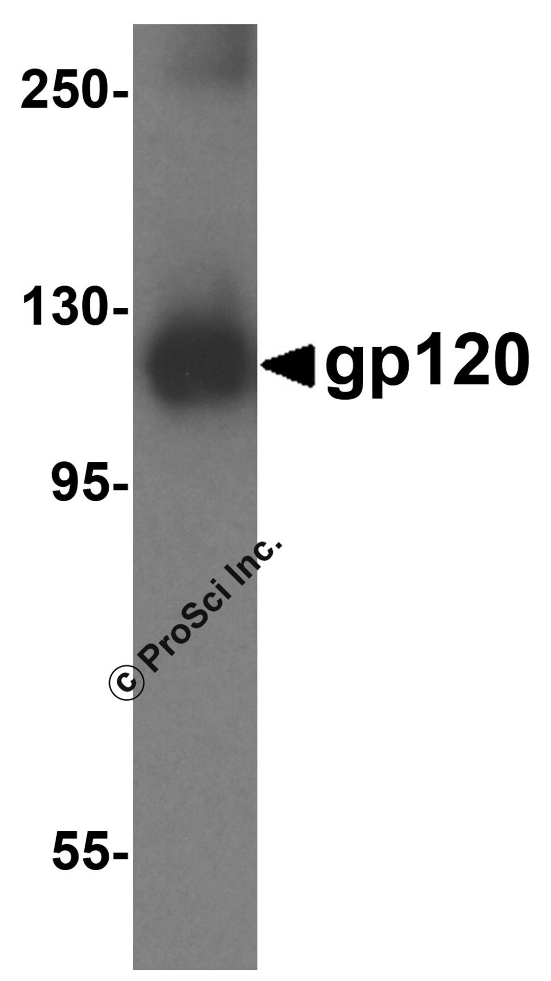 Western blot analysis 1 ng of recombinant gp120 with gp120 antibody at 1 μg/mL.