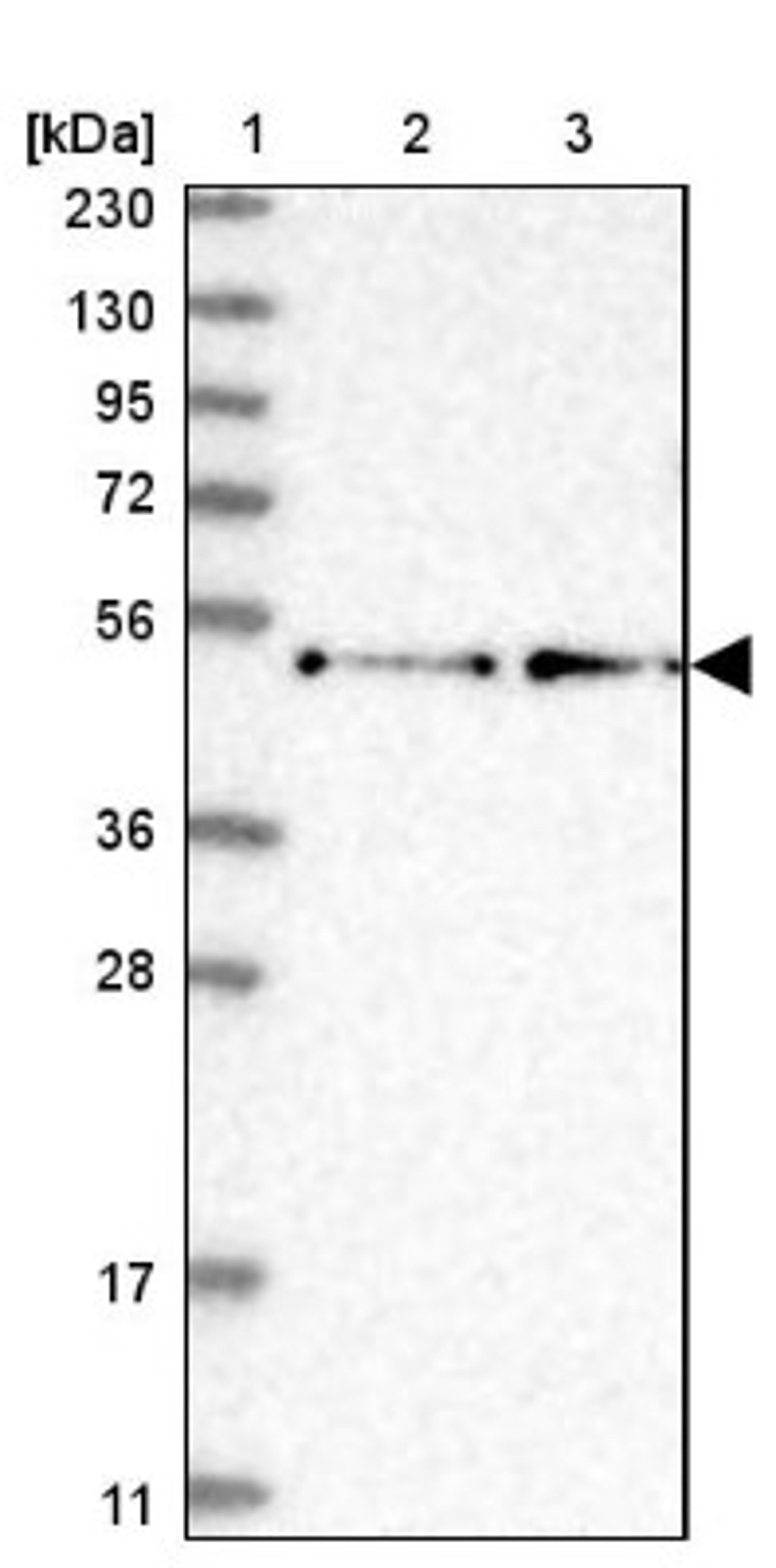 Western Blot: RCOR2 Antibody [NBP1-92323] - Lane 1: Marker [kDa] 230, 130, 95, 72, 56, 36, 28, 17, 11<br/>Lane 2: Human cell line RT-4<br/>Lane 3: Human cell line U-251MG sp