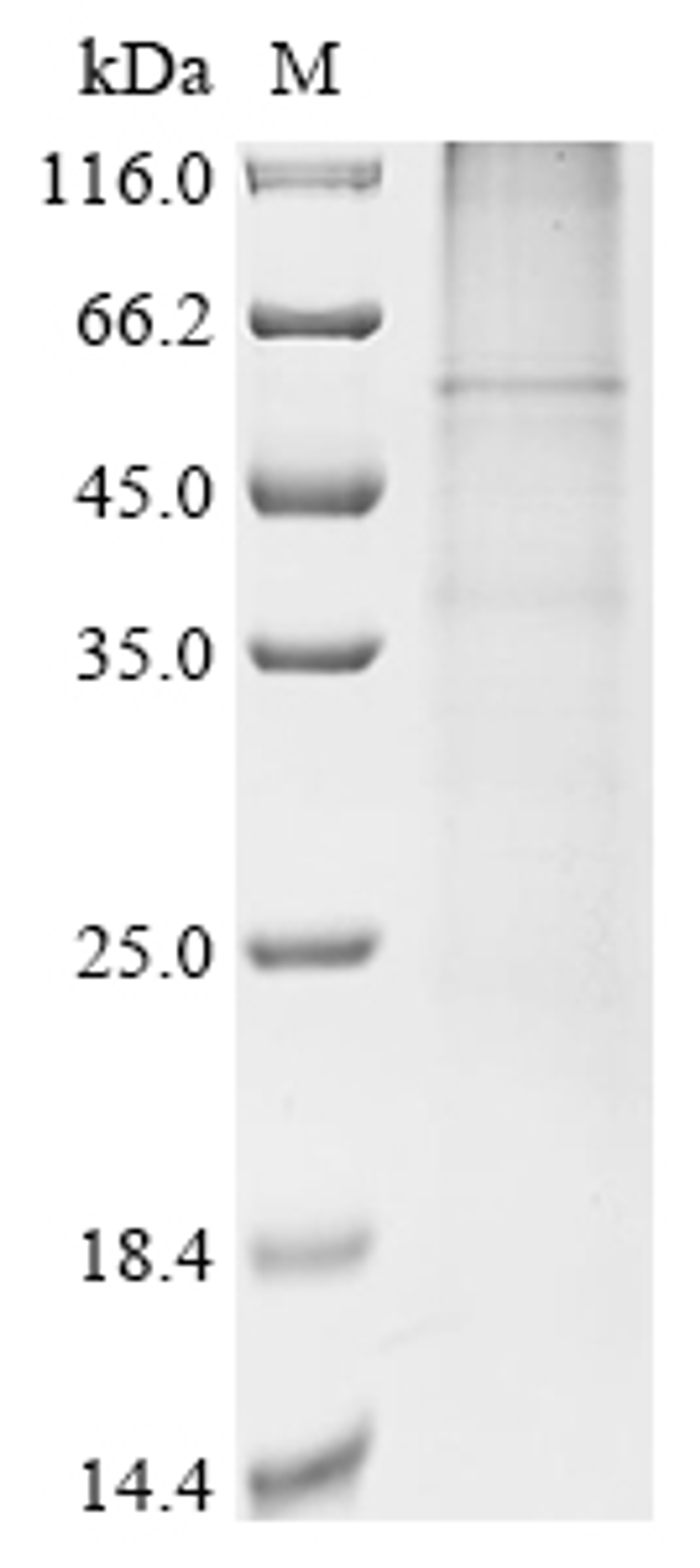 (Tris-Glycine gel) Discontinuous SDS-PAGE (reduced) with 5% enrichment gel and 15% separation gel.