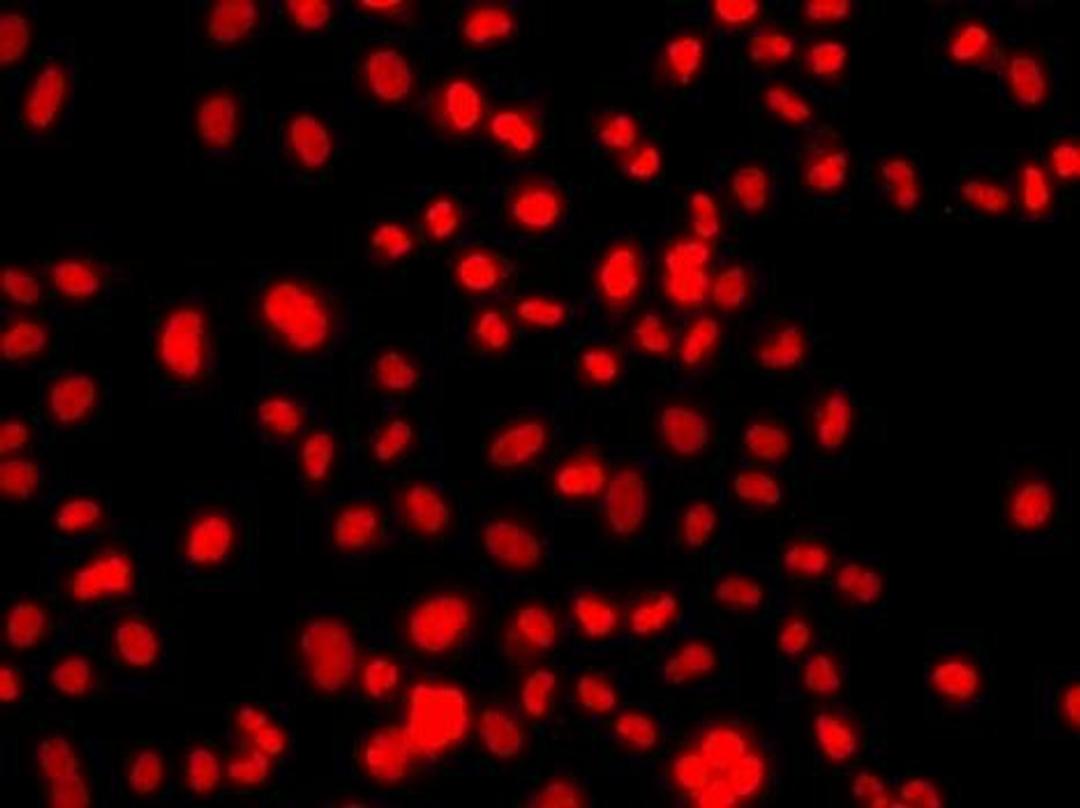 Immunofluorescence analysis of A549 cell using PRICKLE2 antibody