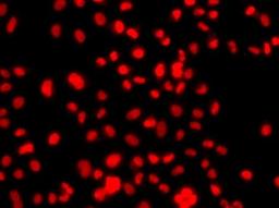 Immunofluorescence analysis of A549 cell using PRICKLE2 antibody