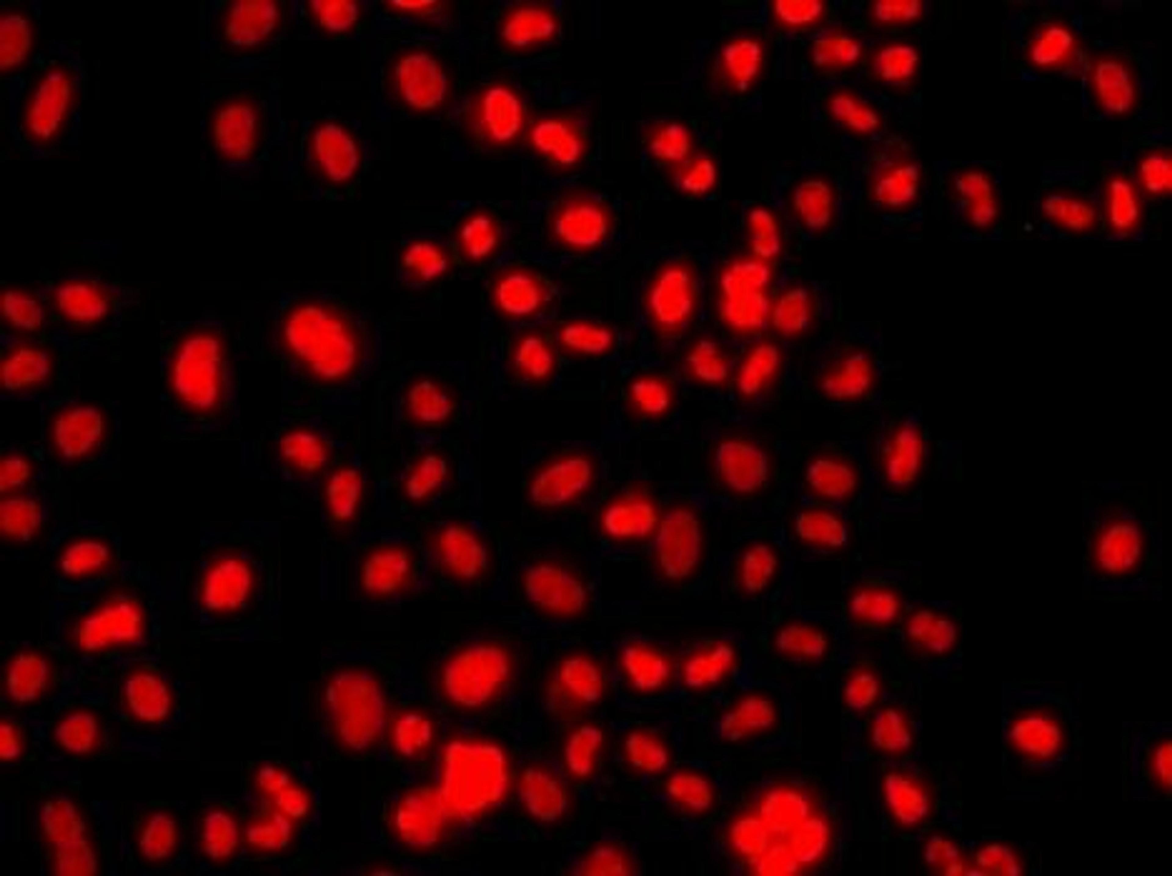 Immunofluorescence analysis of A549 cell using PRICKLE2 antibody